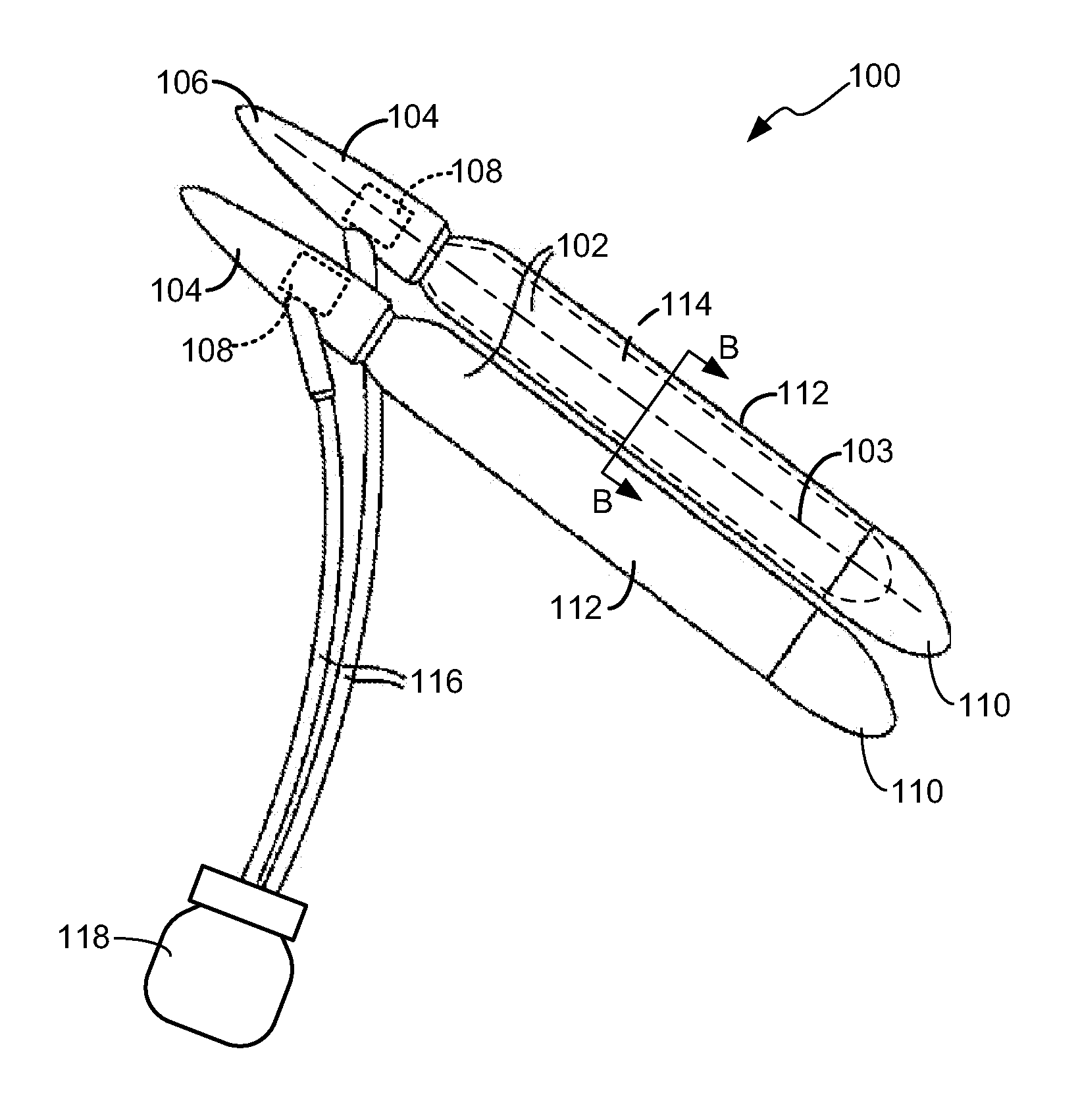 Girth expanding penile prosthesis cylinder