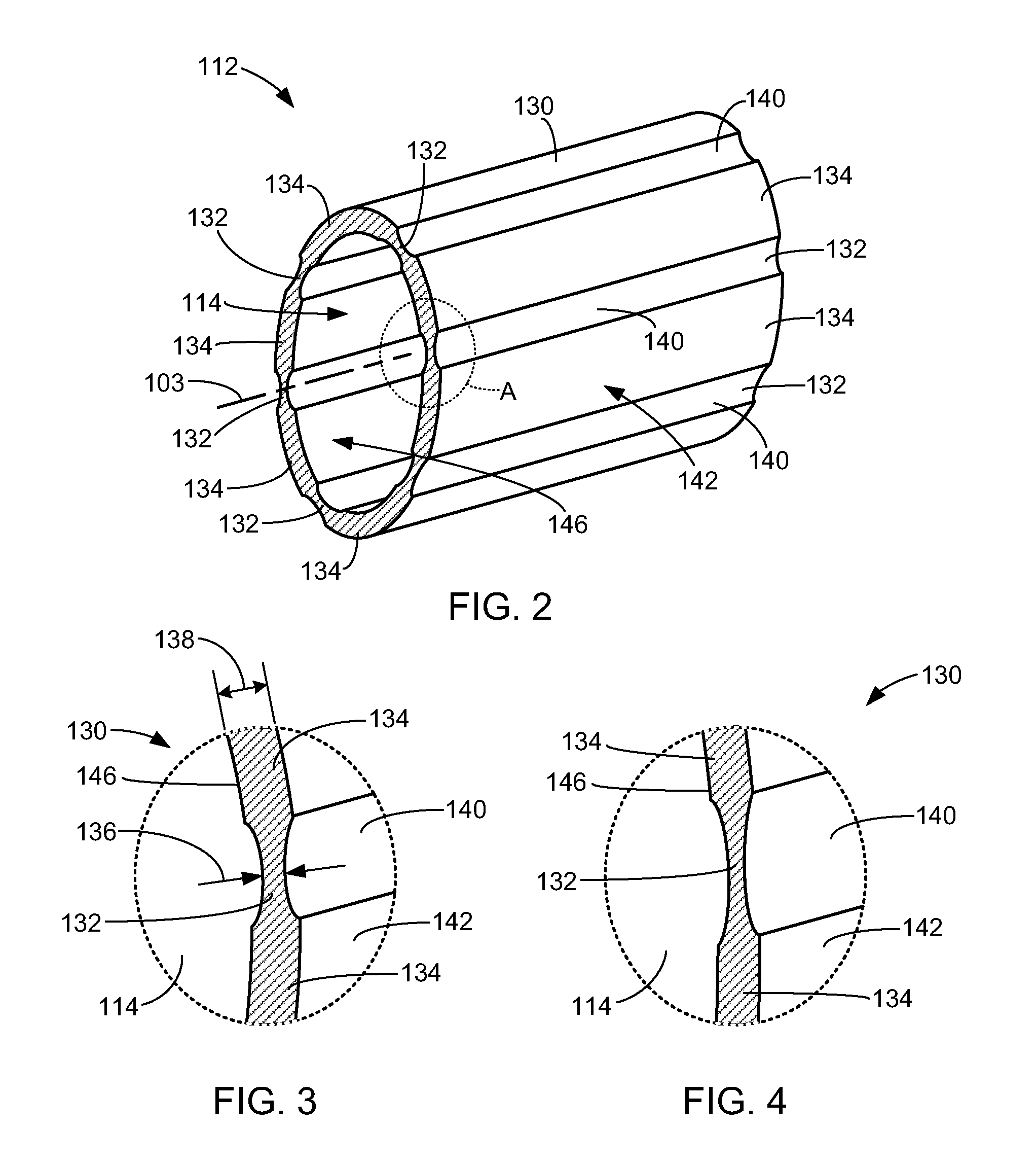 Girth expanding penile prosthesis cylinder