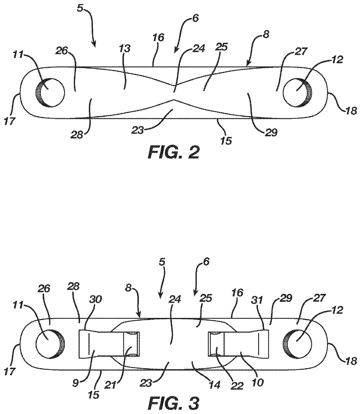 Method and apparatus for a continuous compression implant