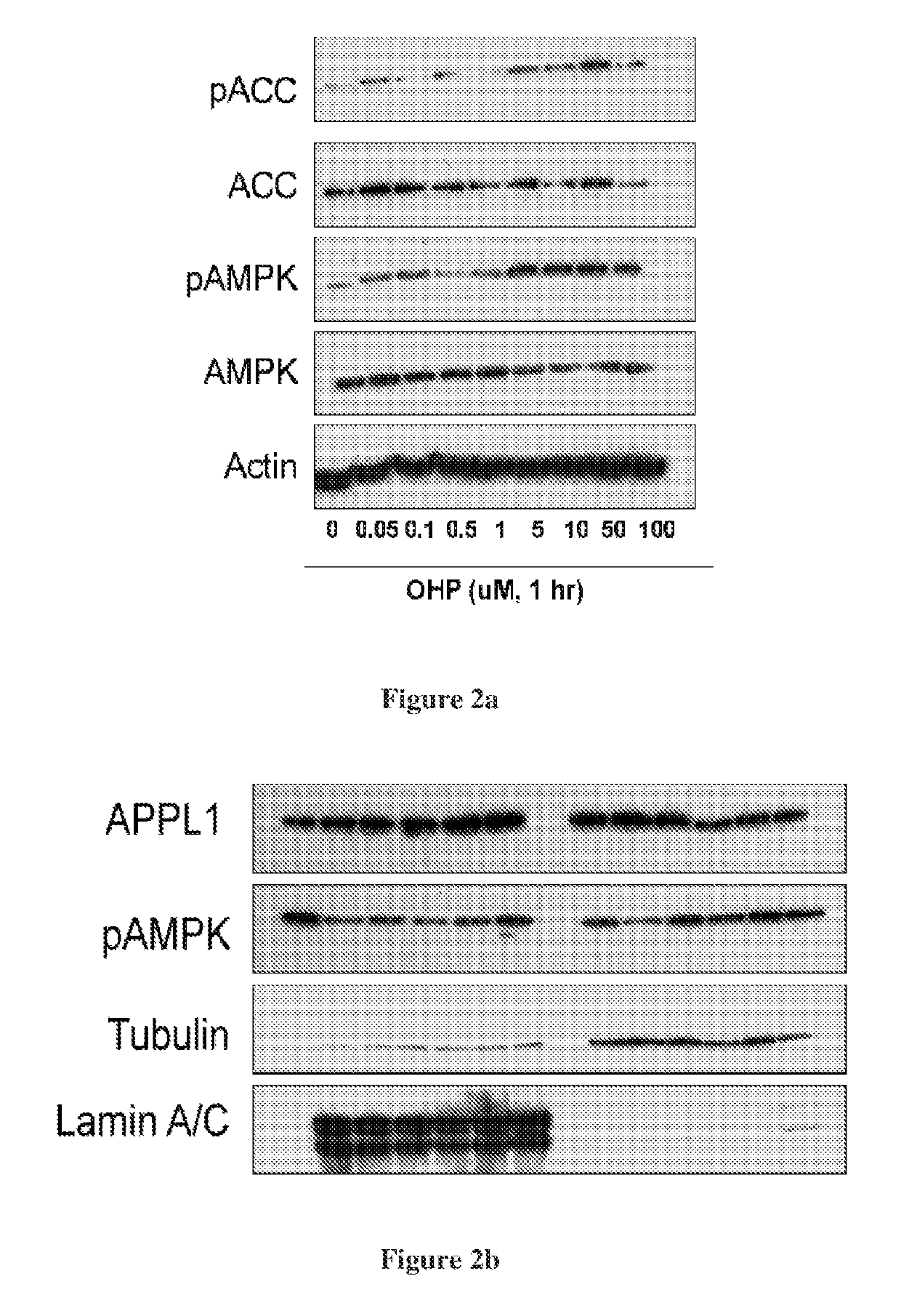 Hydroxysteroid compounds, their intermediates, process of preparation, composition and uses thereof