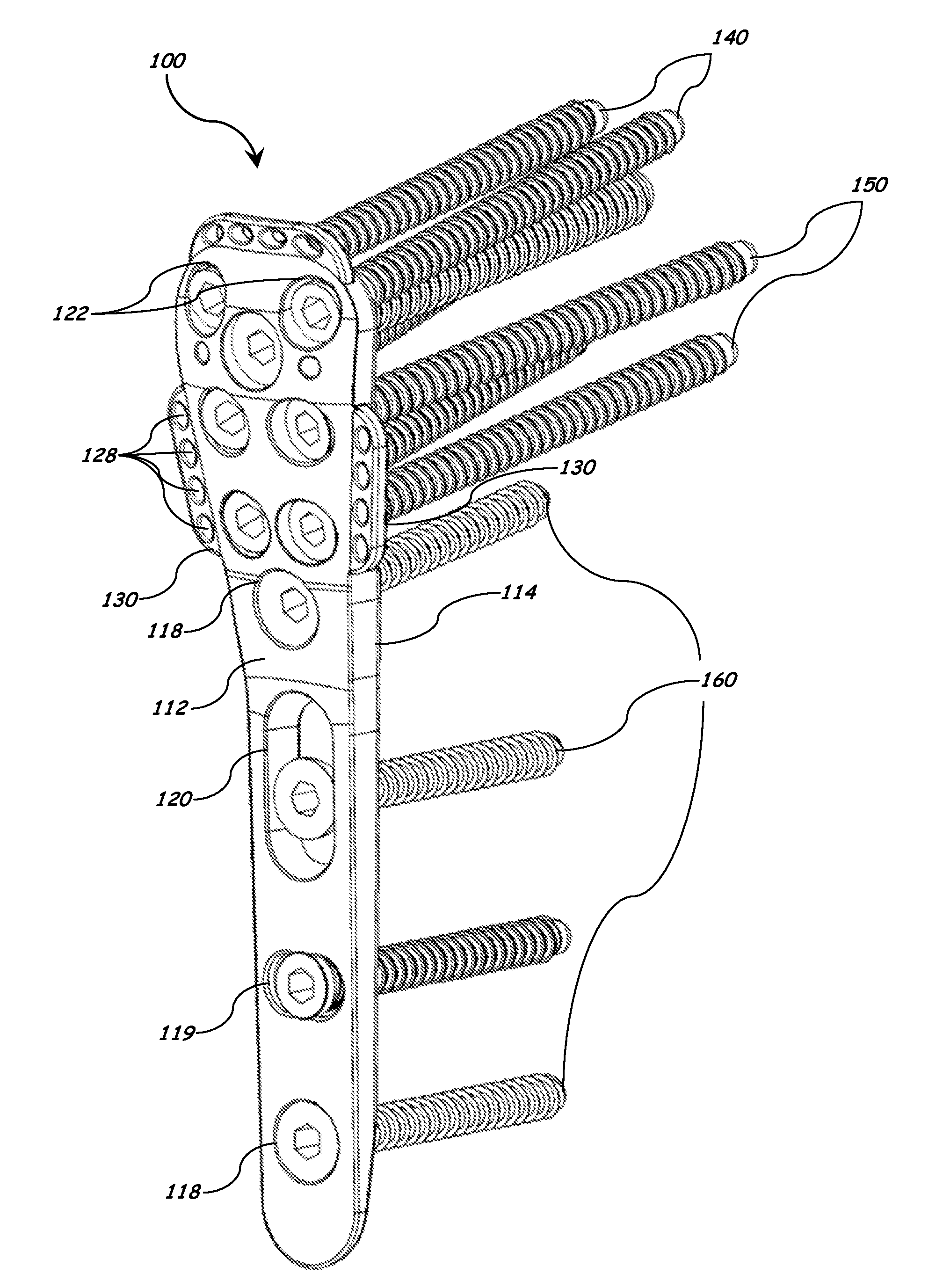 Bone plate with elevated suture hole structures