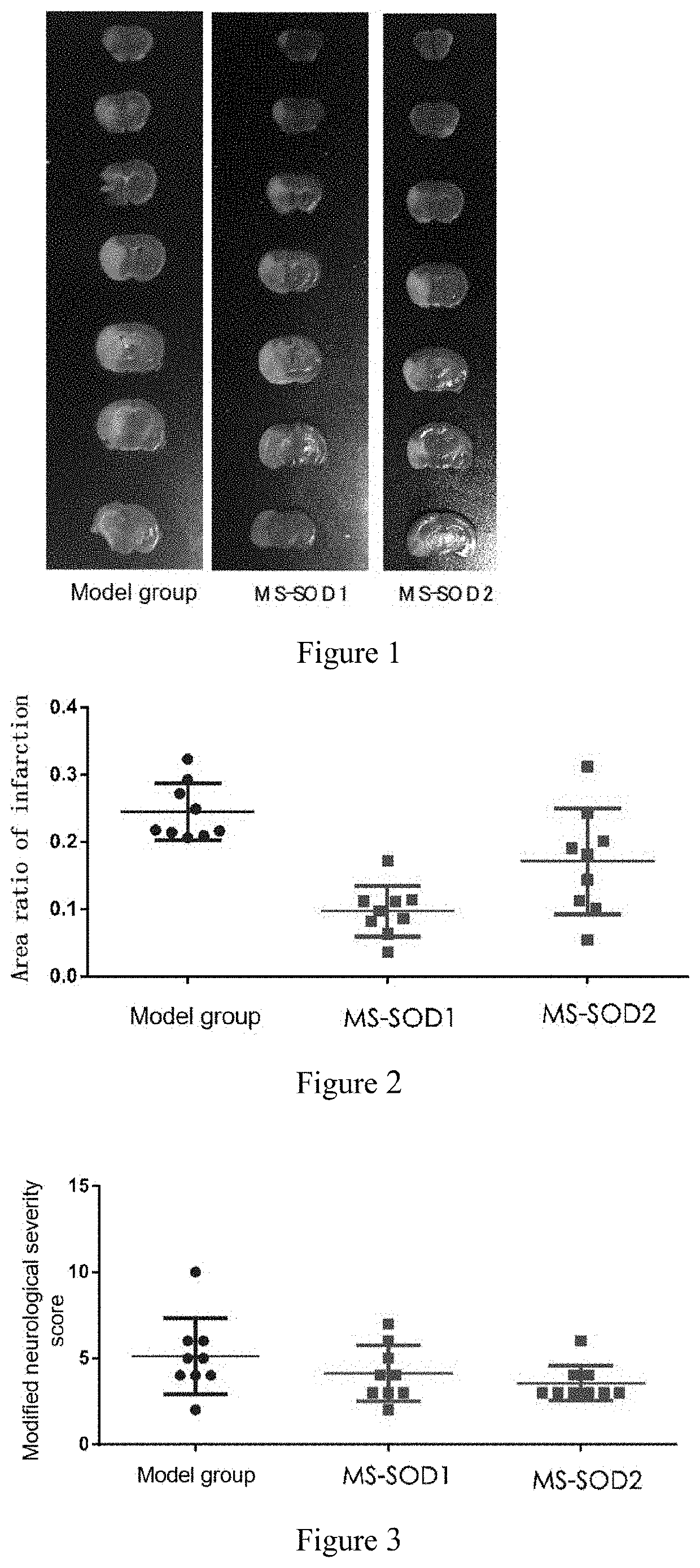 Use of a manganese superoxide dismutase with high stability in the prevention or treatment of cerebral stroke