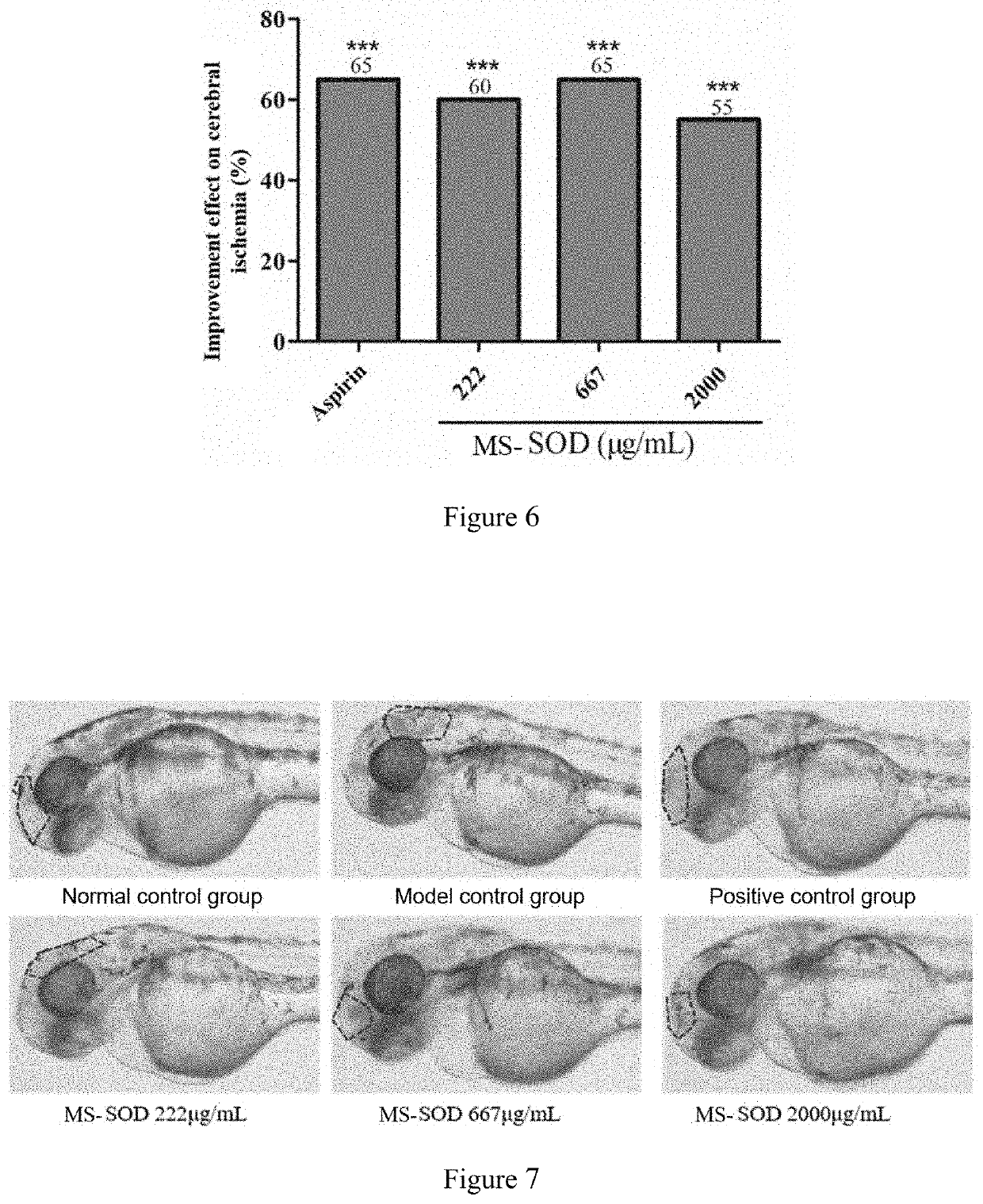 Use of a manganese superoxide dismutase with high stability in the prevention or treatment of cerebral stroke