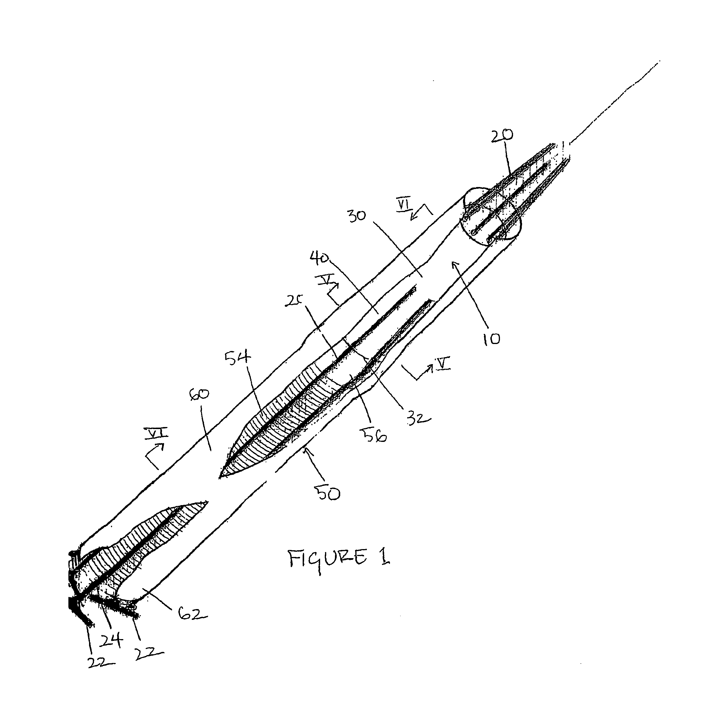 Method and apparatus for fitting grips