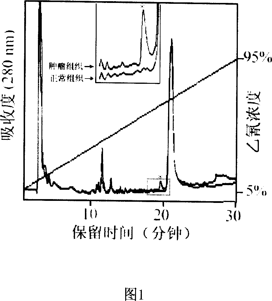 Use of human phylaxin-1,2,3 protein in cancer detecting molecular mark