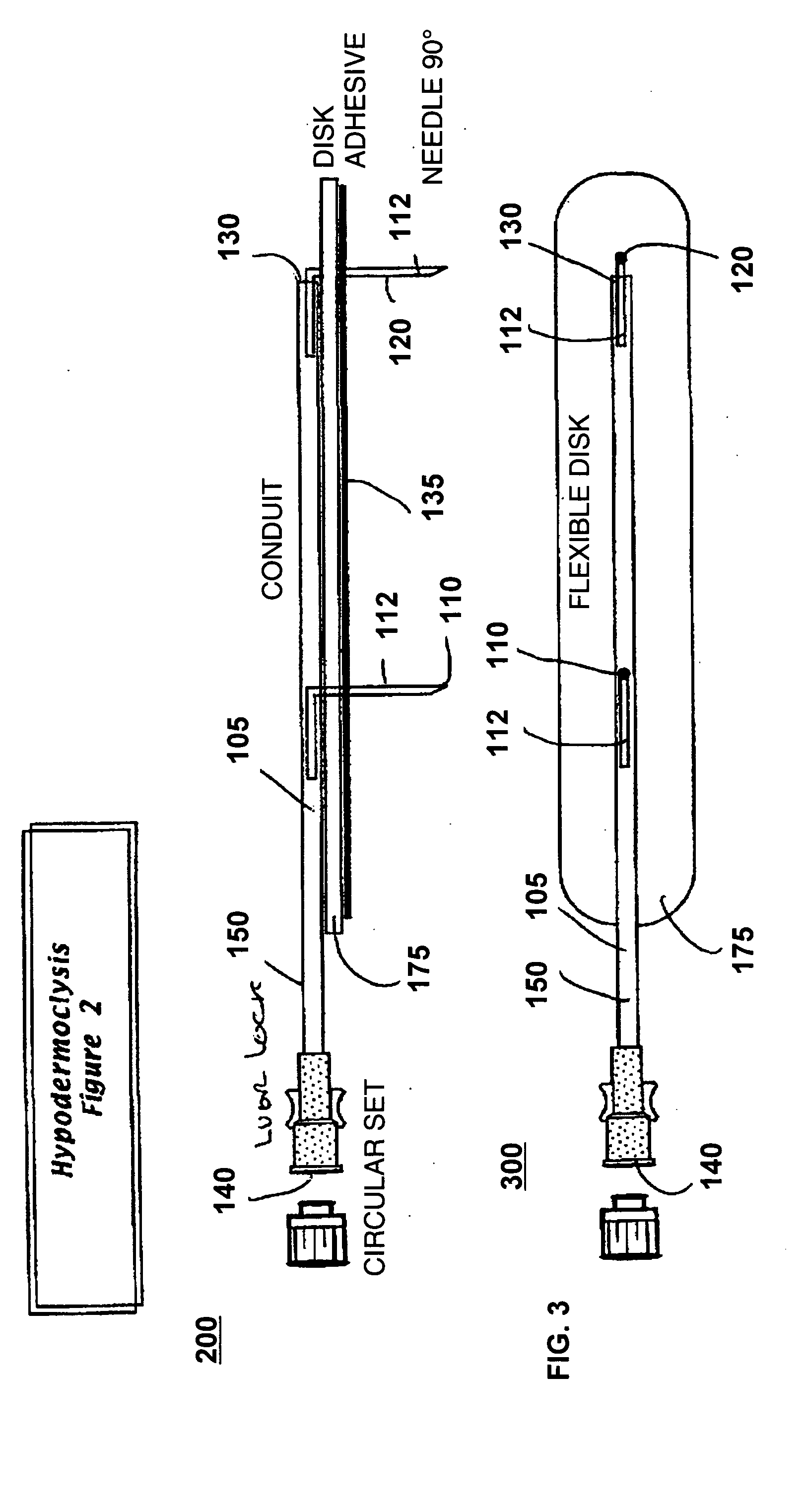 Device for subcutaneous infusion of fluids