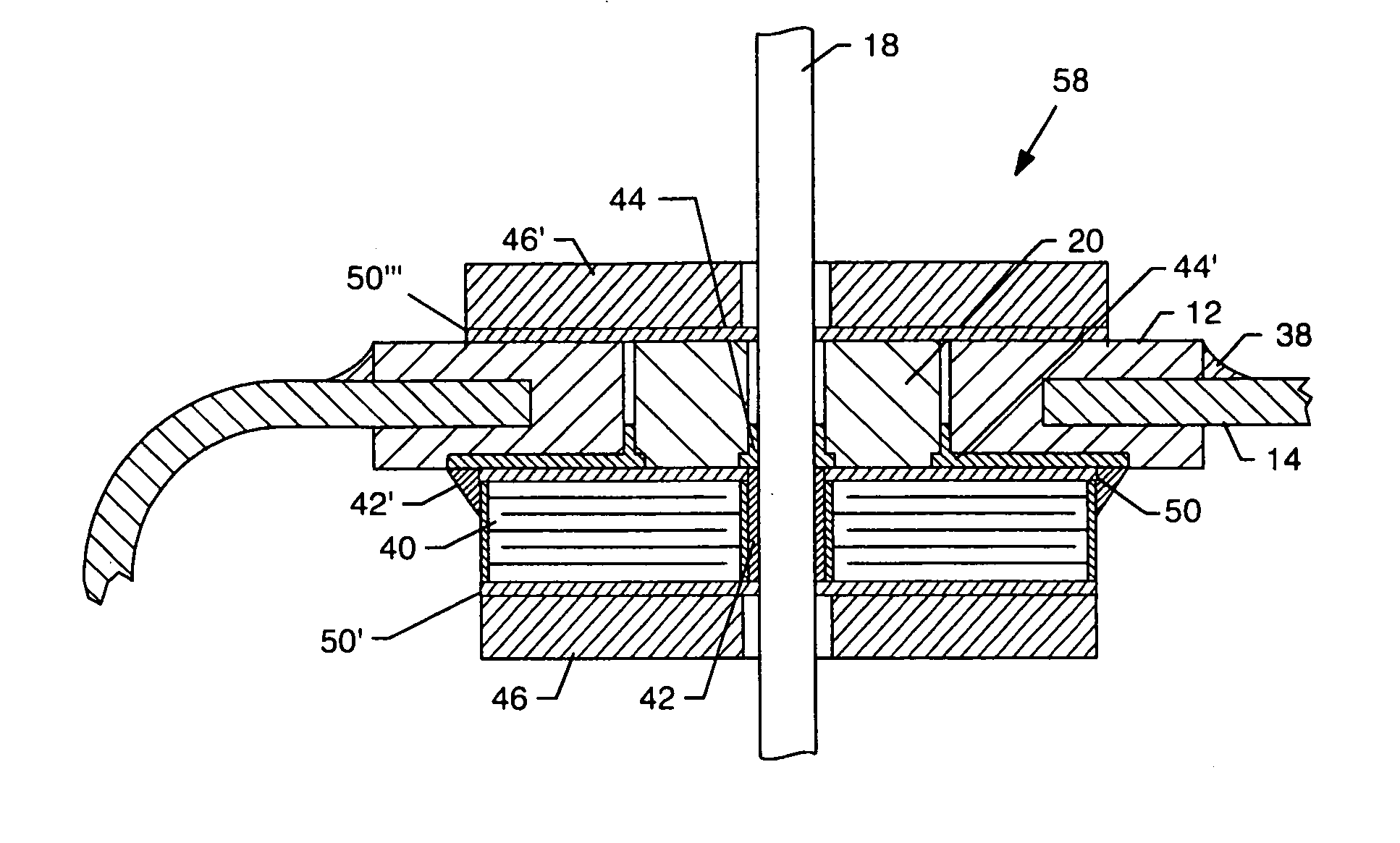 Inductor capacitor EMI filter for human implant applications