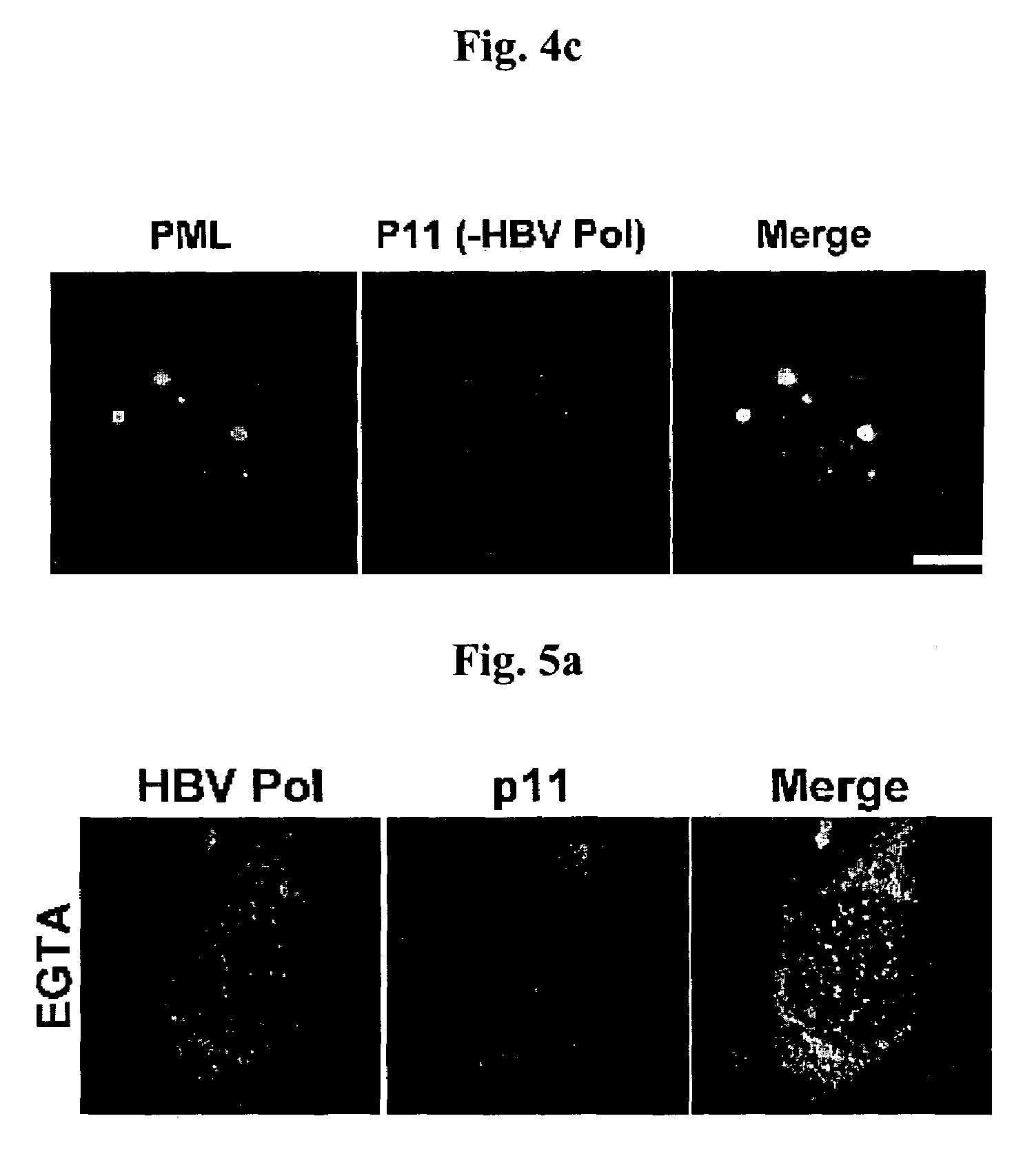 Complex of Hepatitis B virus polymerase with p11 and method for controlling movement of the complex in HepG2 cell