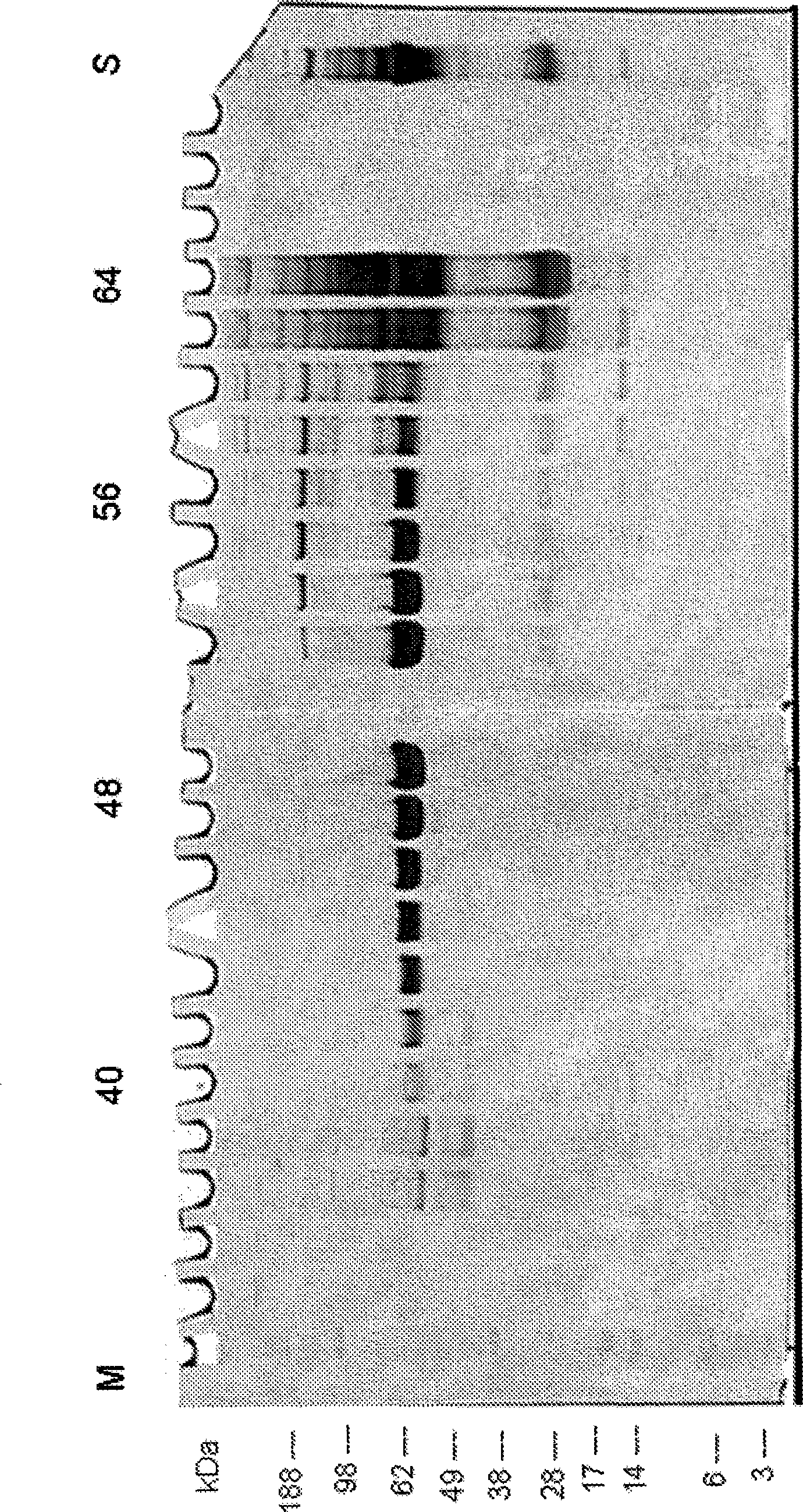 Method and device for separation and depletion of certain proteins and particles using electrophoresis