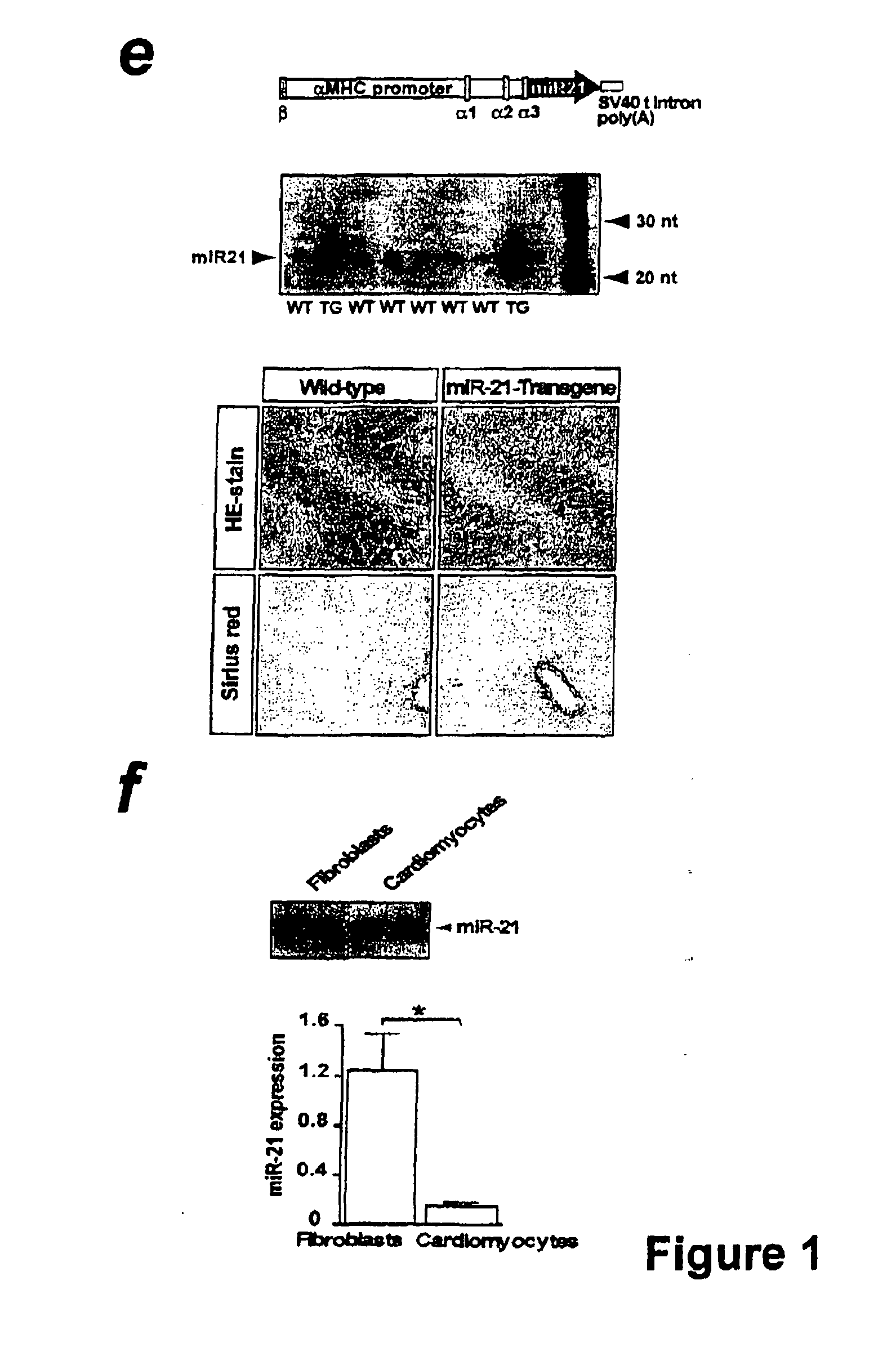 MICRORNA (miRNA) AND DOWNSTREAM TARGETS FOR DIAGNOSTIC AND THERAPEUTIC PURPOSES