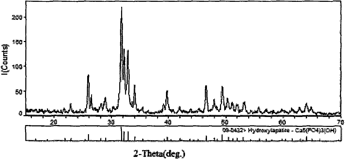 Preparation method for nano hydroxylapatite doped with metal ions