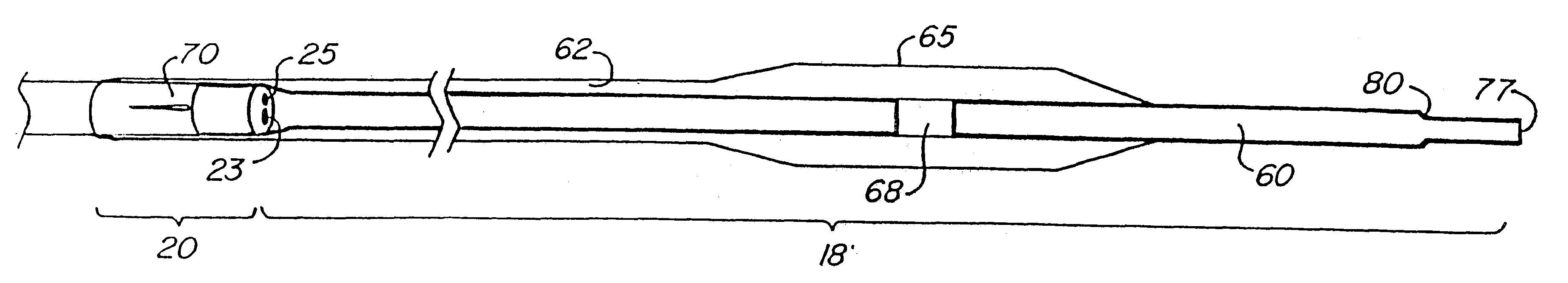 Catheter system having a balloon angioplasty device disposed over a work element lumen