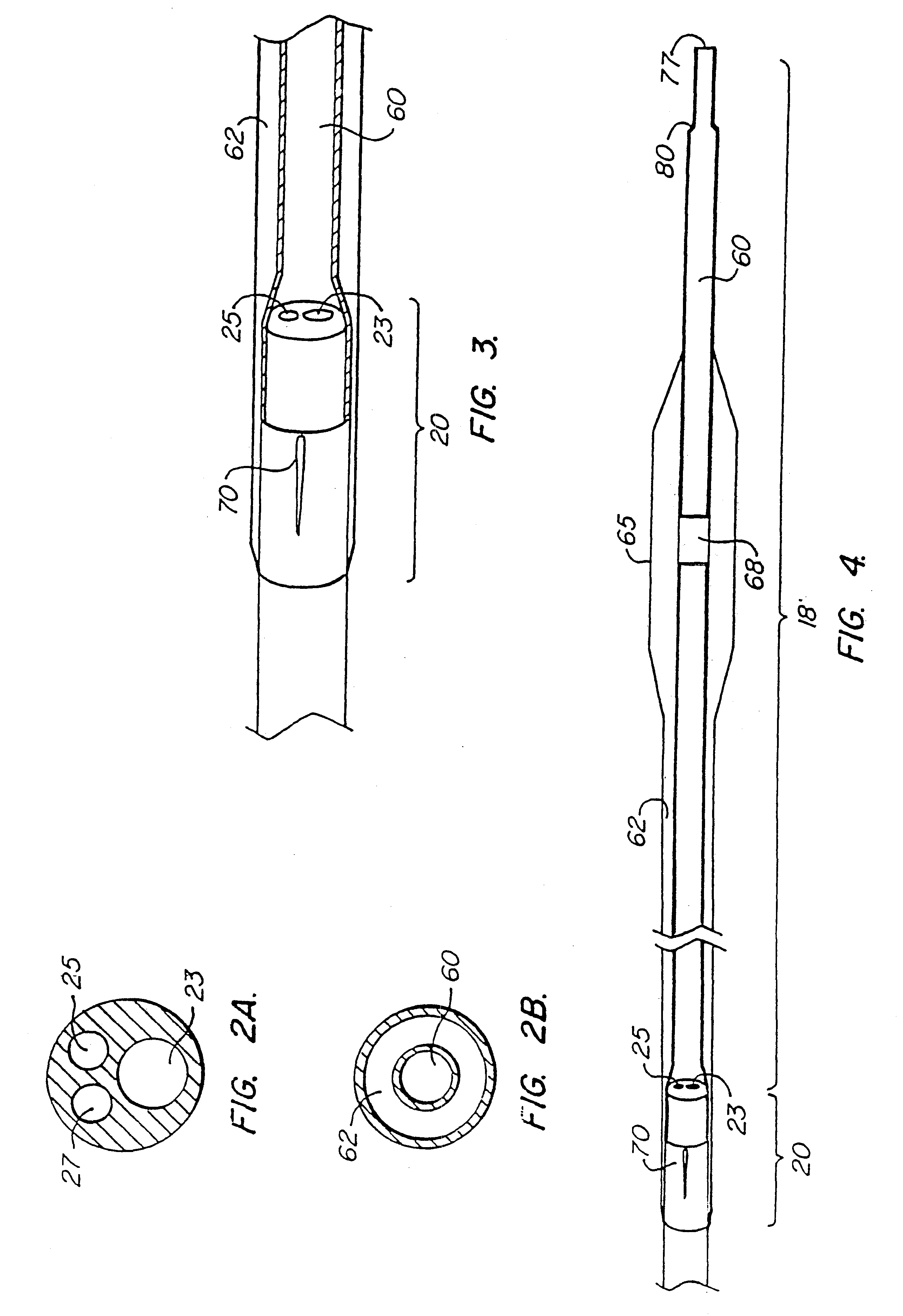 Catheter system having a balloon angioplasty device disposed over a work element lumen