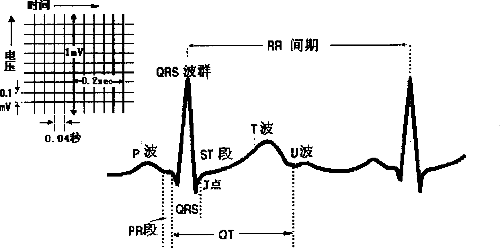 Method and apparatus for detecting, and analysing heart rate variation predication degree index
