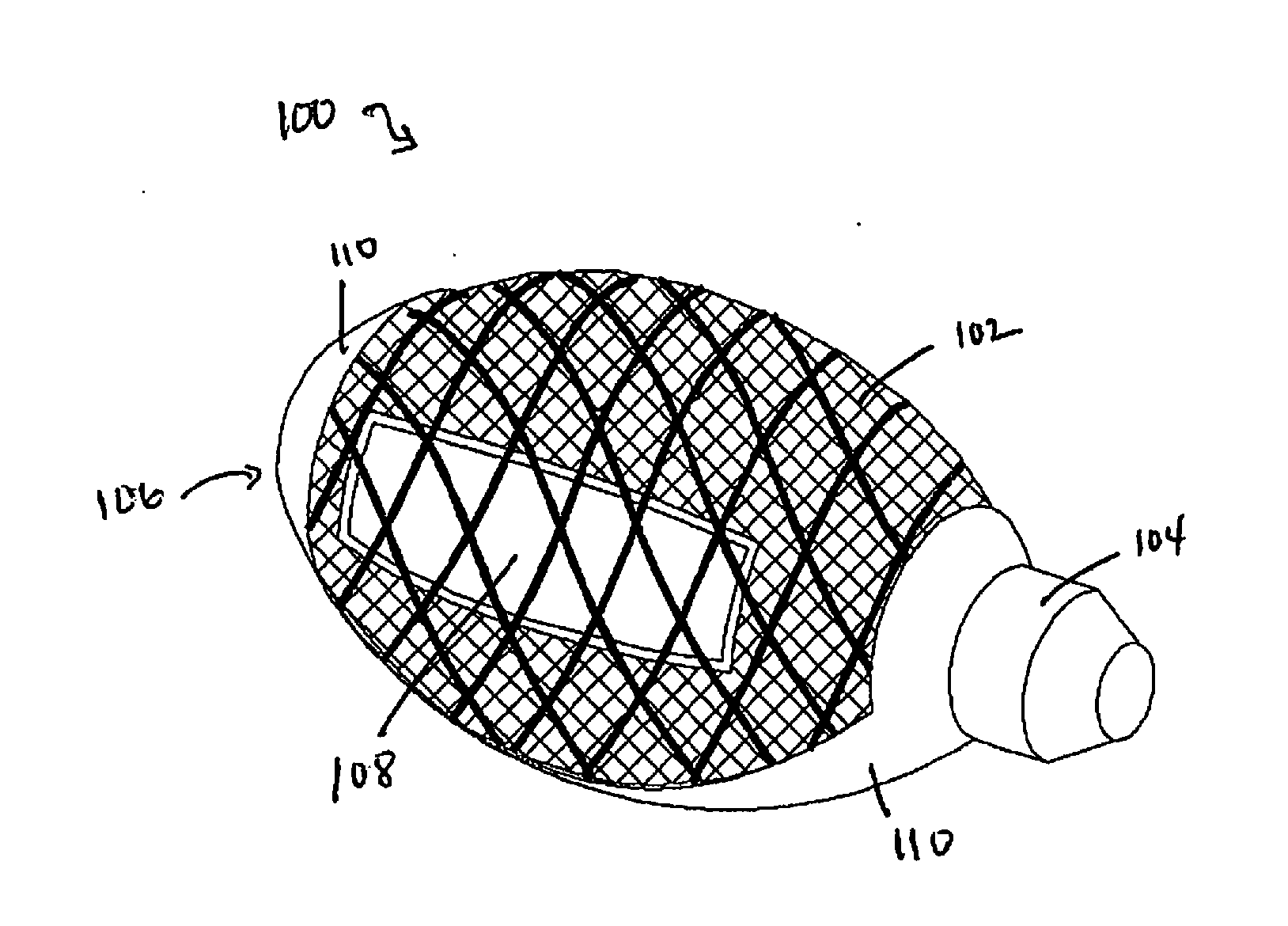 Cement-Directing Orthopedic Implants