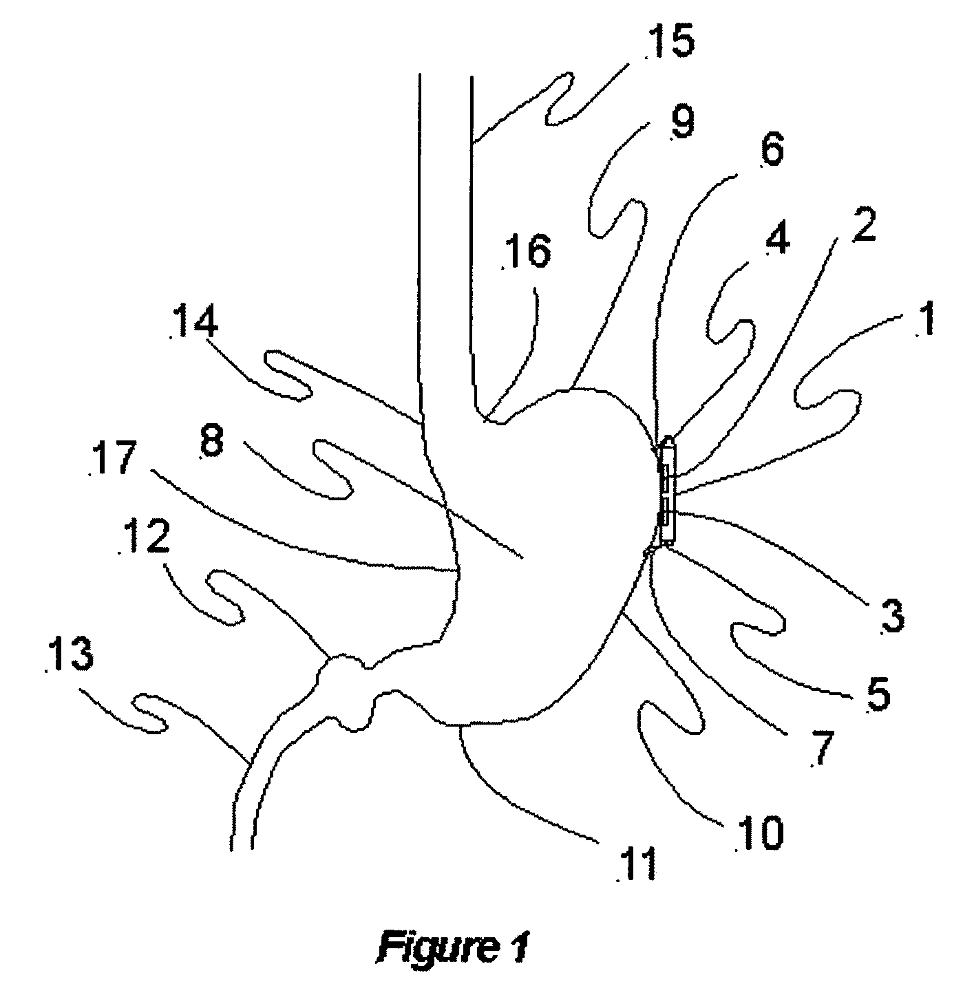 Methods and apparatus for neuromodulation and physiologic modulation for the treatment of obesity and metabolic and neuropsychiatric disease
