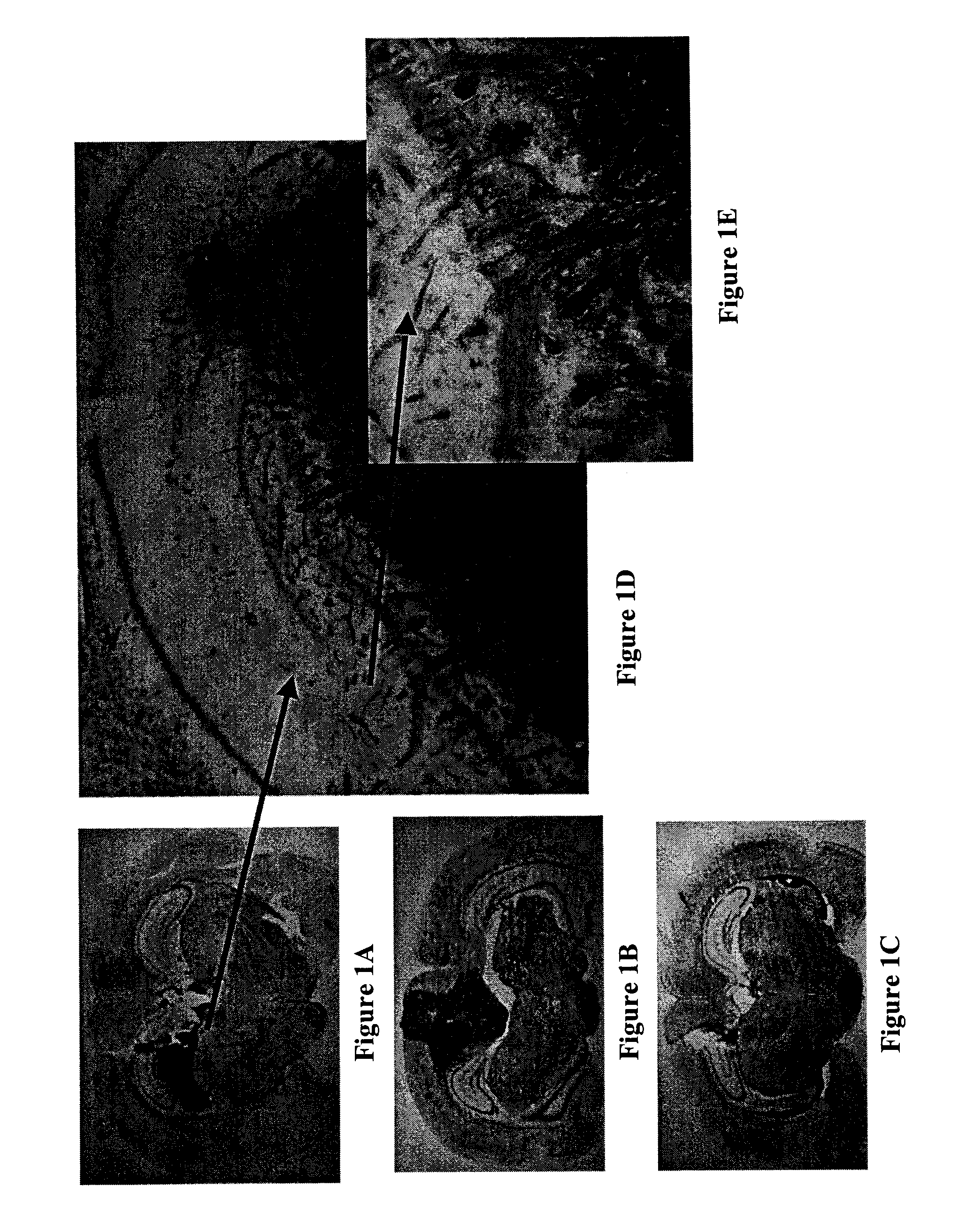 Substituted Tetrahydroisoquinoline Compounds for Cancer Therapy