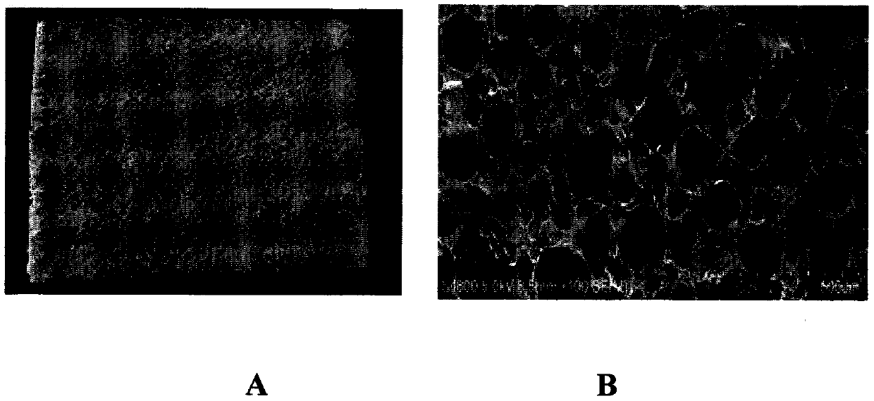 Water-absorbent antibacterial dressing for burn injuries and wounds and preparation method and application thereof