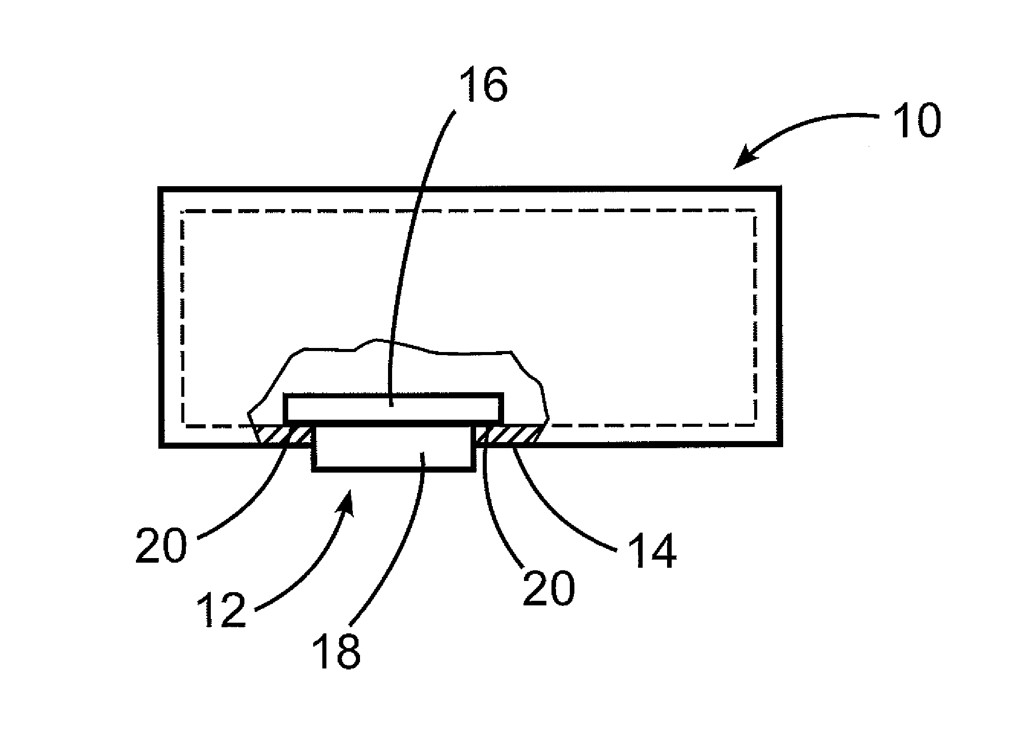 Pressure release device for housings with flameproof encapsulation with porous body having interference fit