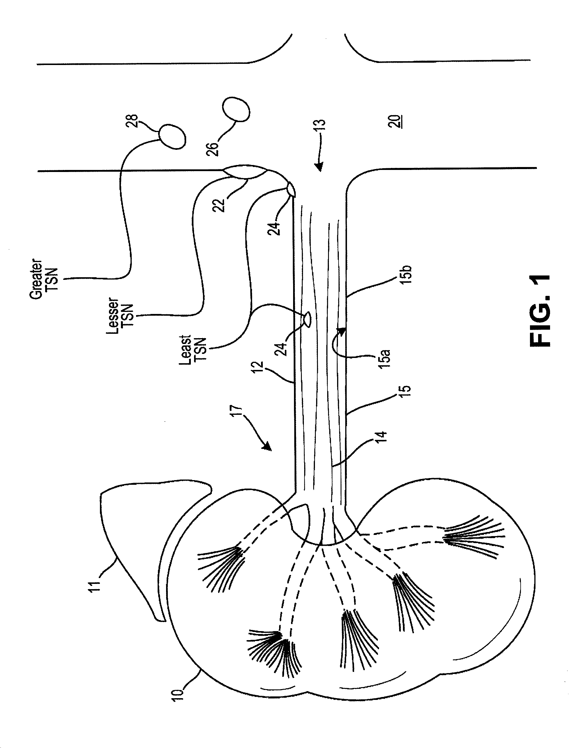 Tissue treatment device and related methods