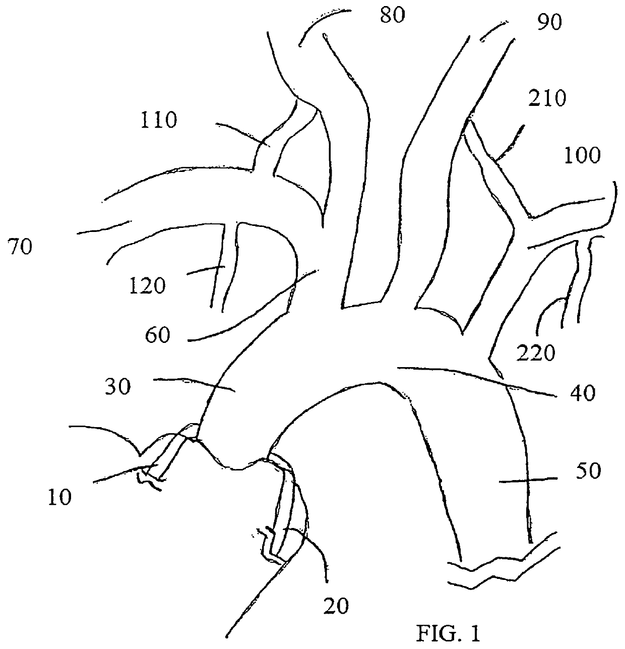 Trans-radial access endovascular catheter and method of use