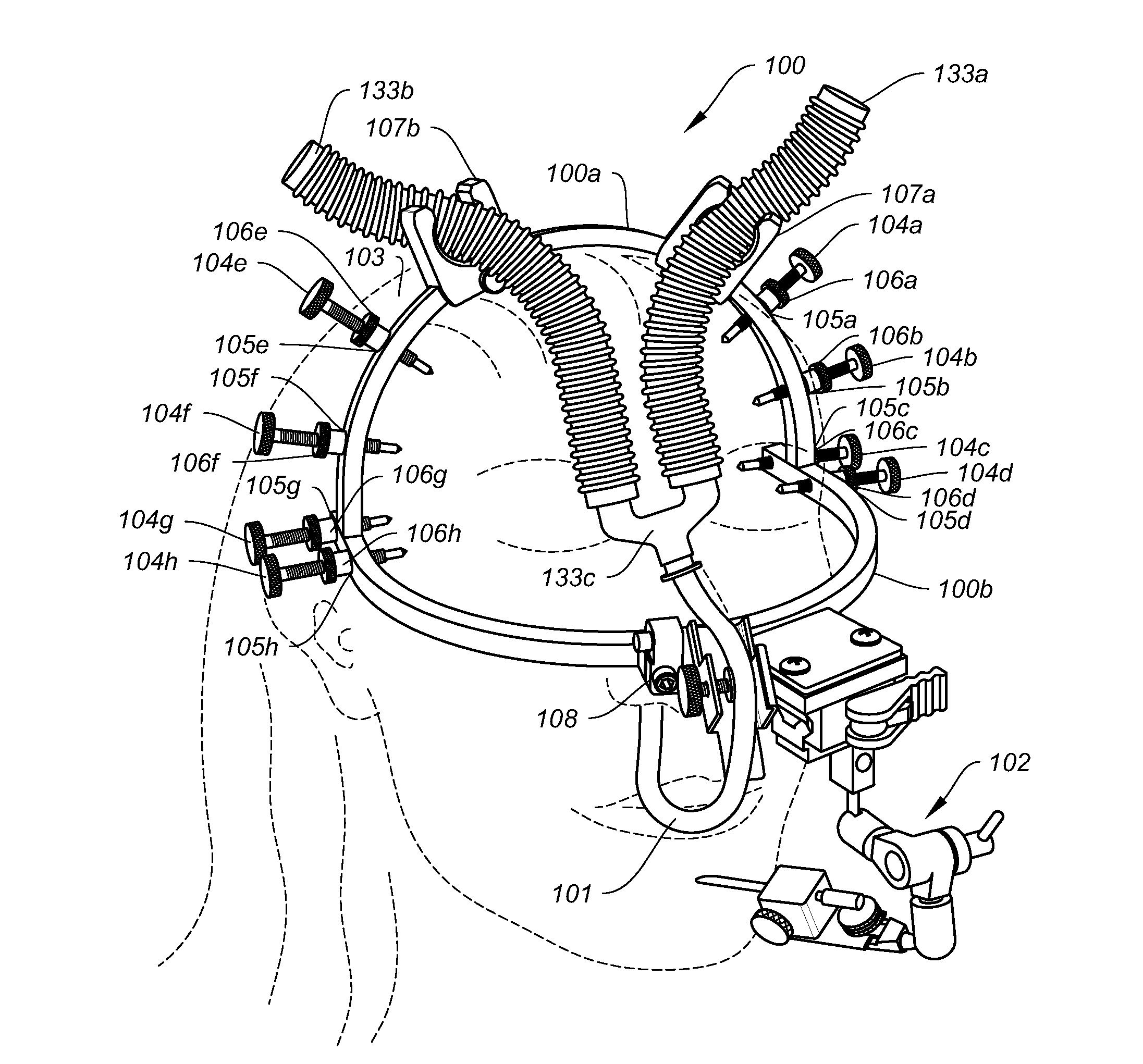 Apparatus and method for oral and maxillofacial surgery and preoperative modeling