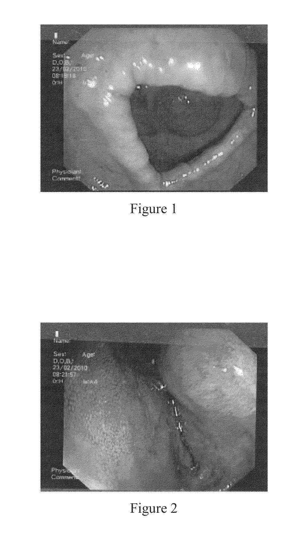 Solid composition for the oral administration of dyes and diagnostic use thereof