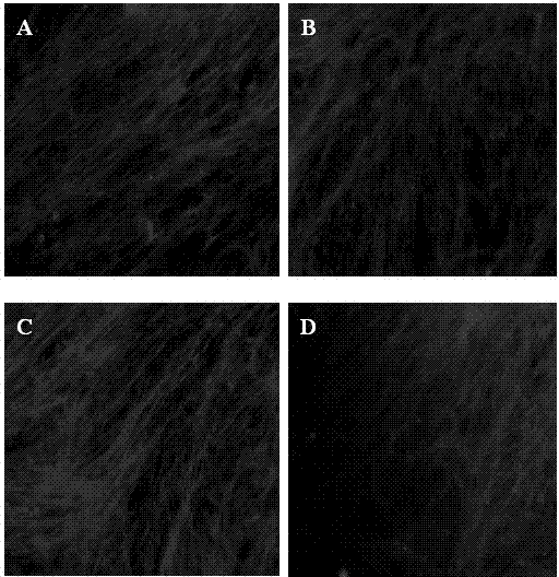 Electrostatic spinning nanofiber-extracellular matrix composite material as well as preparation method and application thereof