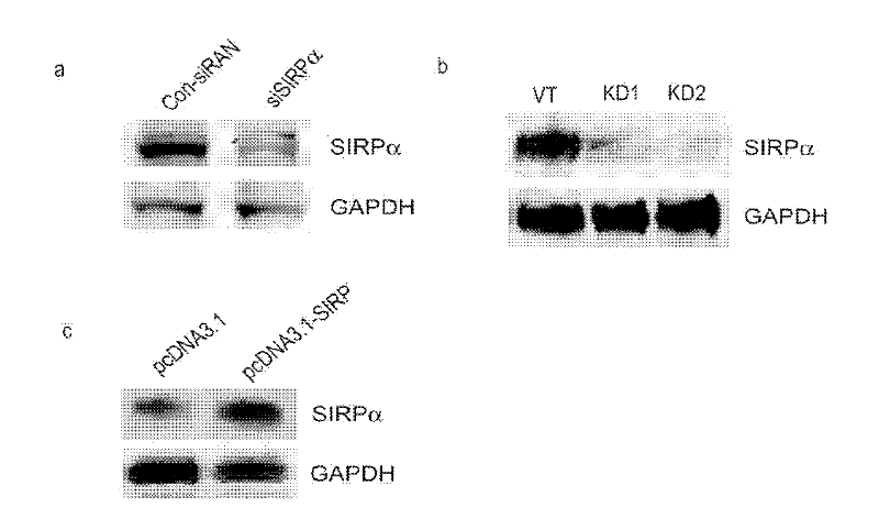 Application of signal-regulatory protein alpha (SIRPalpha) in preparation of medicines for preventing and treating allergic diseases