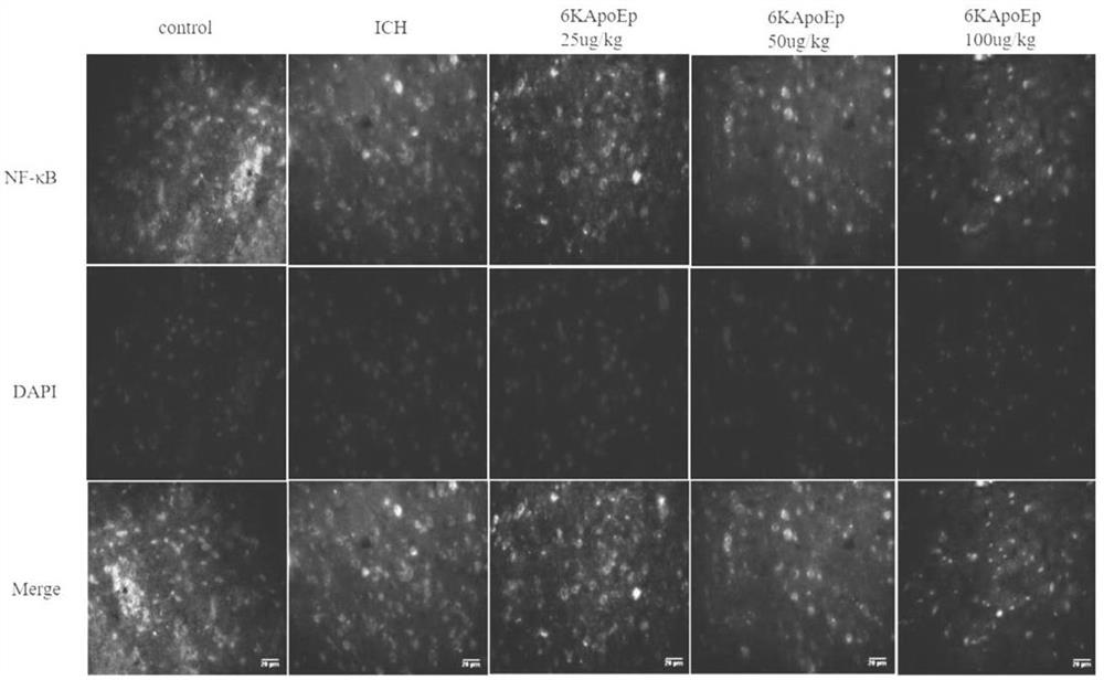 Application of apolipoprotein e receptor mimetic peptide 6kapoep in the preparation of drugs for the treatment of secondary brain injury after cerebral hemorrhage