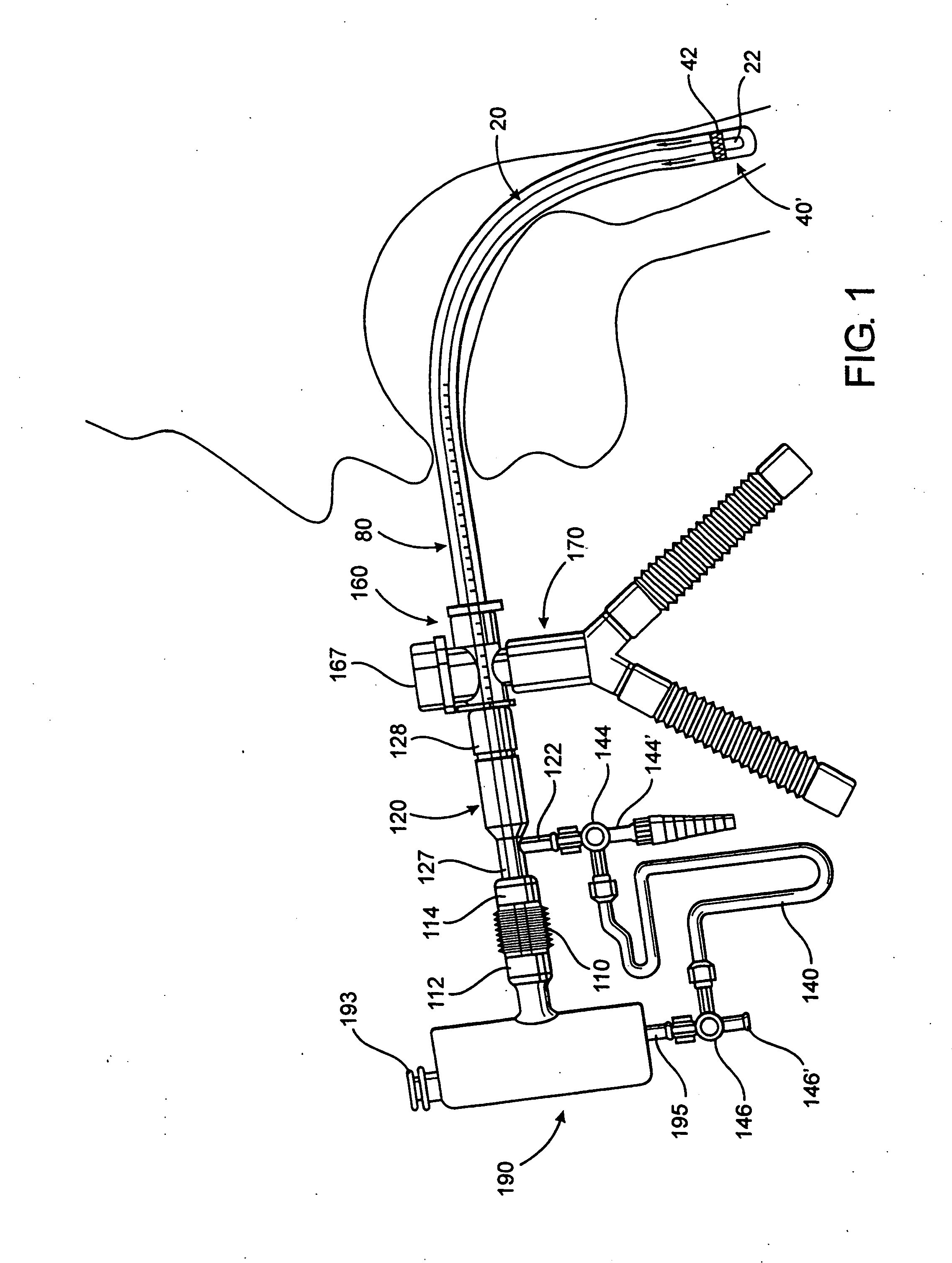 Endotracheal tube cleaning apparatus