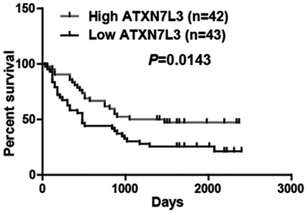 Application of ATXN7L3 in liver cancer diagnosis, treatment and prognosis