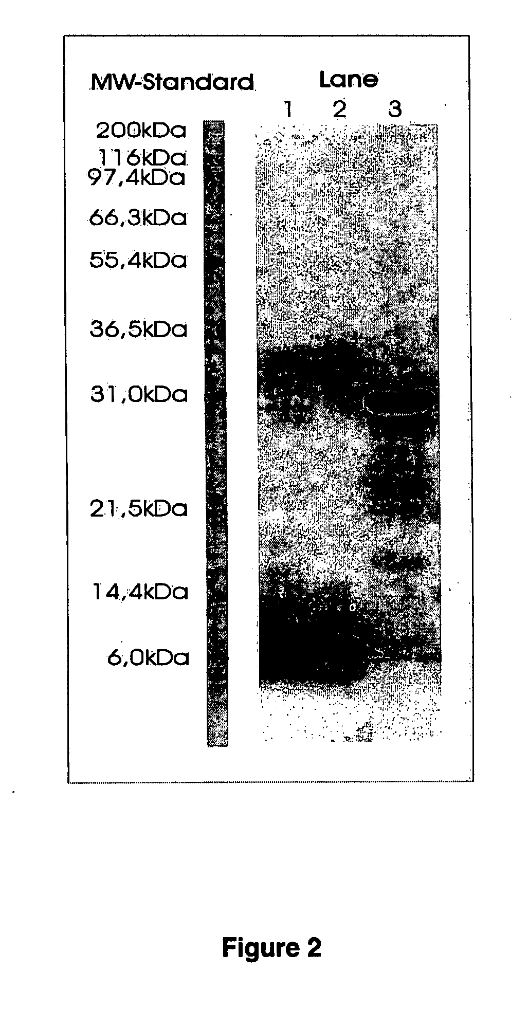 Method of isolation and purification of trypsin from pronase protease and use thereof