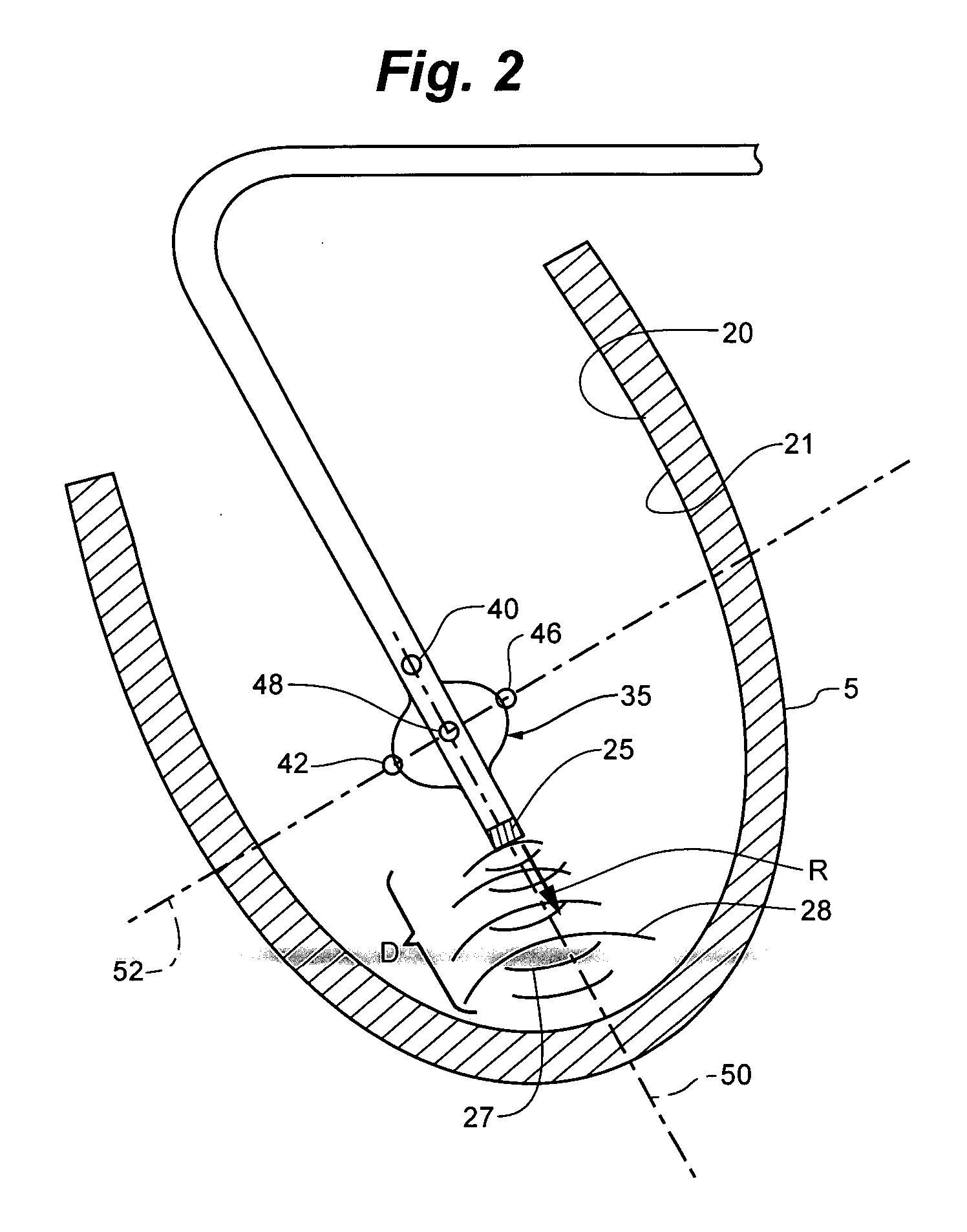System and method for navigating an ultrasound catheter to image a beating heart