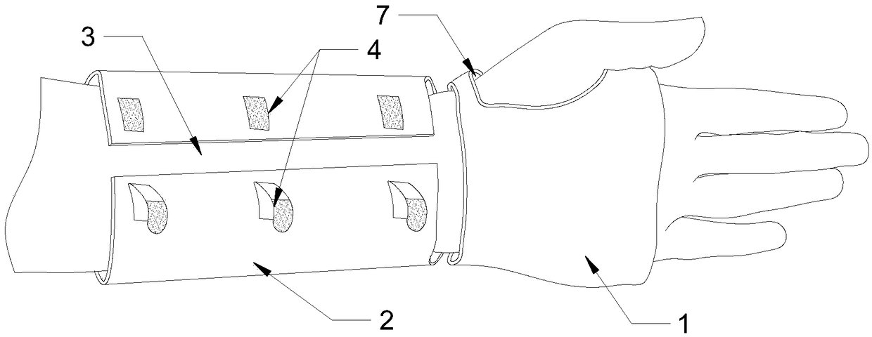 Medical distal radius anatomical scaffold splint and preparation method thereof