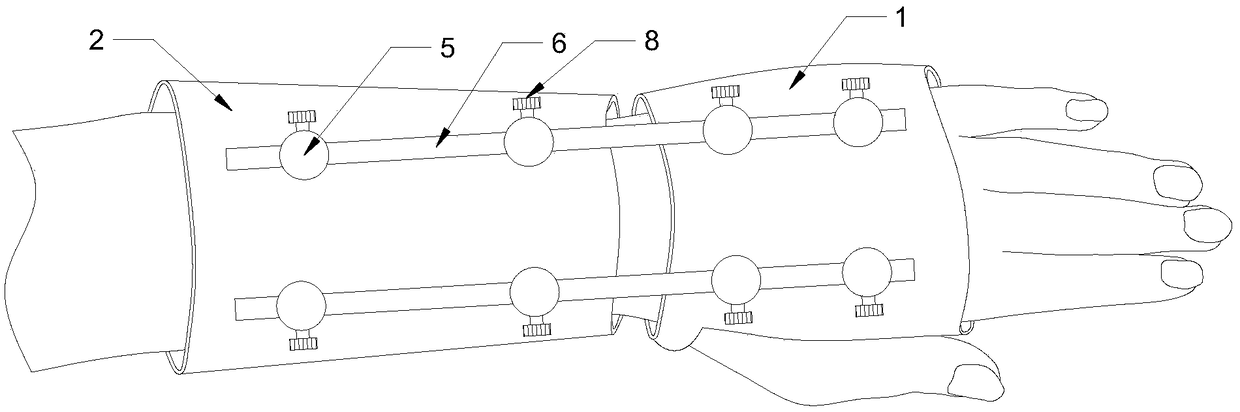 Medical distal radius anatomical scaffold splint and preparation method thereof