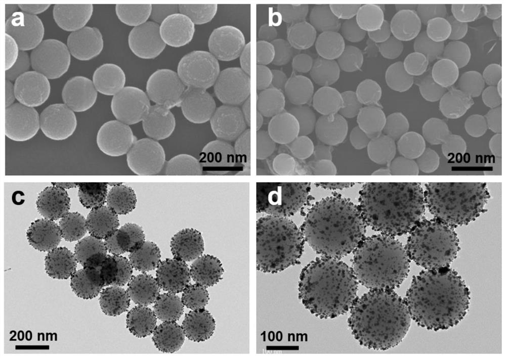 Electrochemical immunodetection method of total homocysteine