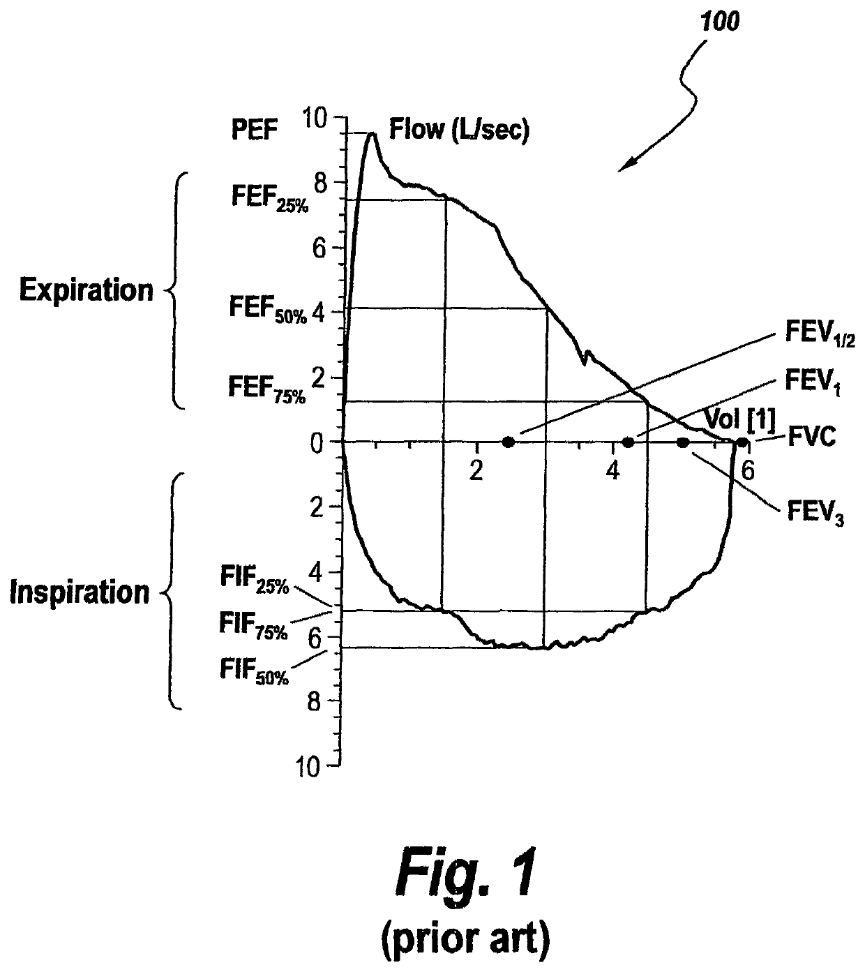 Method and apparatus for intelligent flow sensors