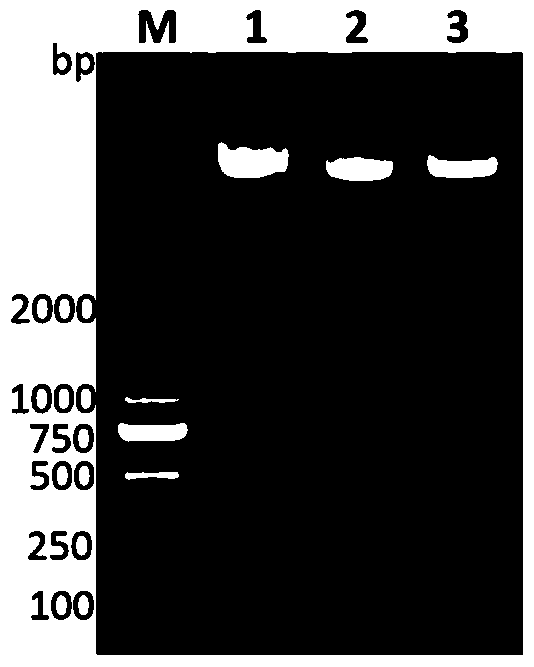 Hepatic abscess-causing Klebsiella pneumoniae specific gene sequence asnc and its application