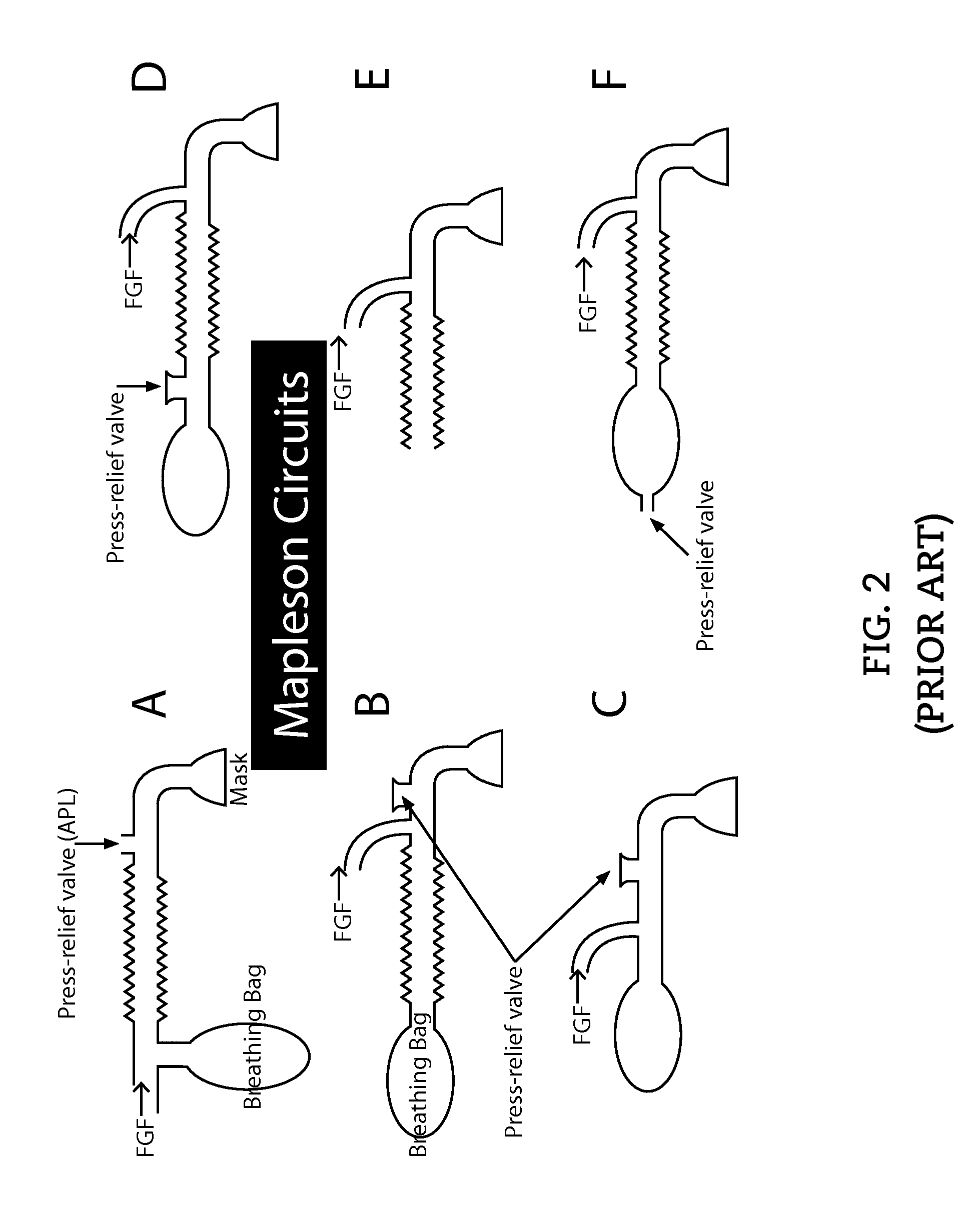 Apparatus, System and Method of Remotely Actuating a Manual Ventilation Bag
