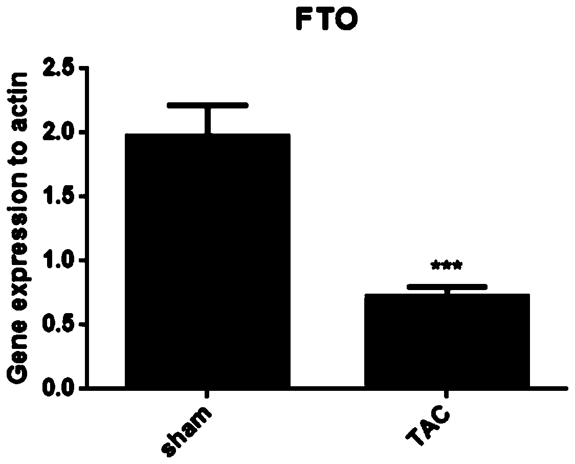 Application of FTO as target in treatment of pressure-loaded myocardial injury