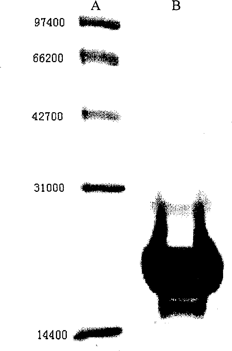 Gene of coding recombination buman natriurea and method of producing recombination human natriurea using the gene