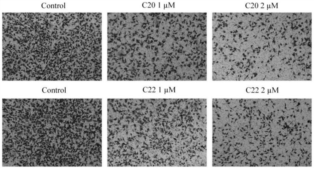 Application of bis-imidazolium salt and drug loading system as anticancer preparation and anticancer preparation