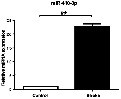 Serum exosome miR-410-3p serving as acute cerebral infarction diagnosis marker and detection method thereof