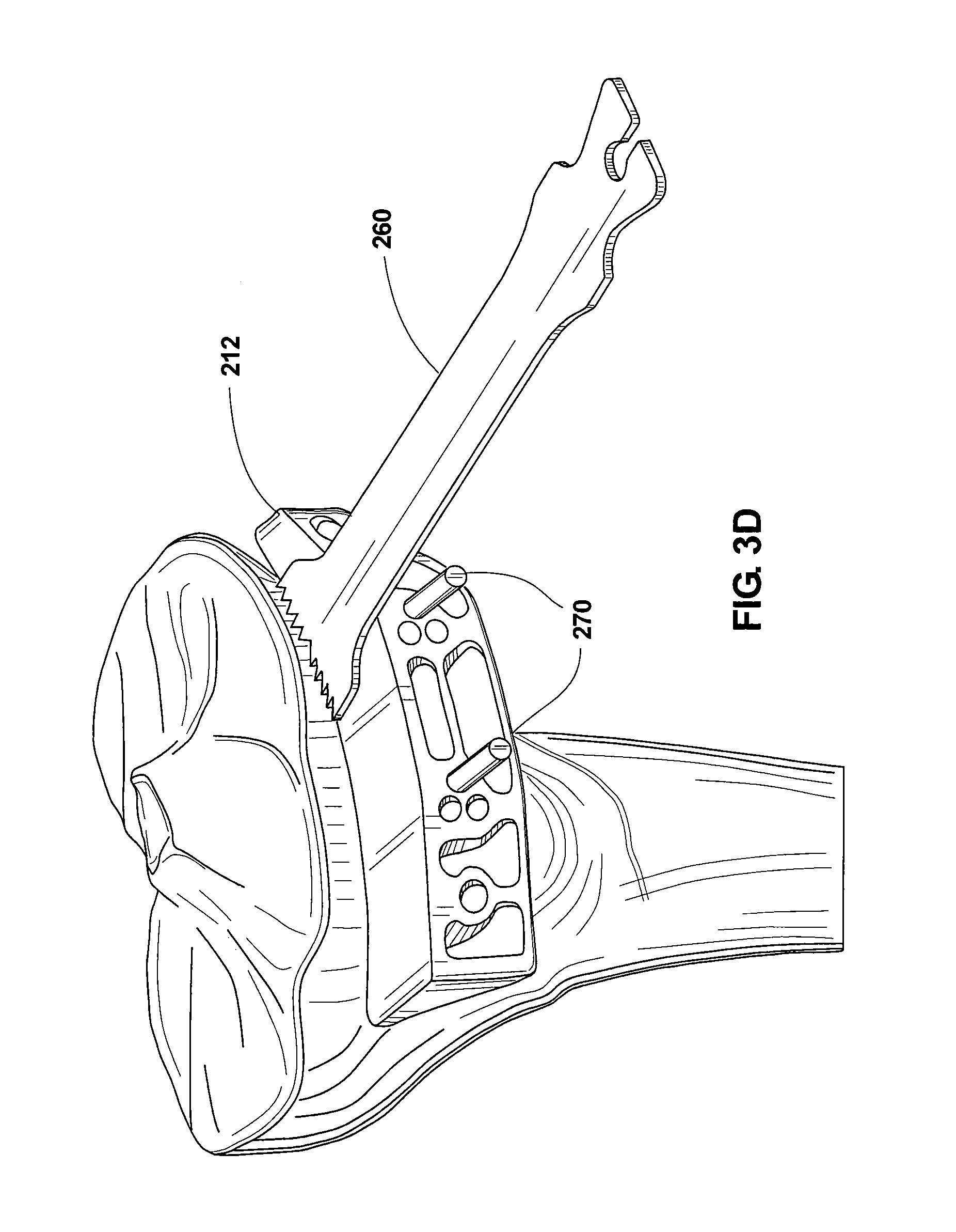 Bone positioning device and method