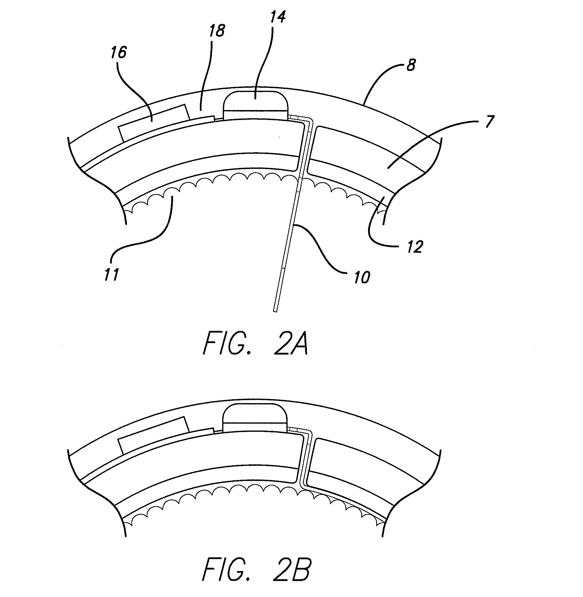 Cortical Implant System for Brain Stimulation and Recording