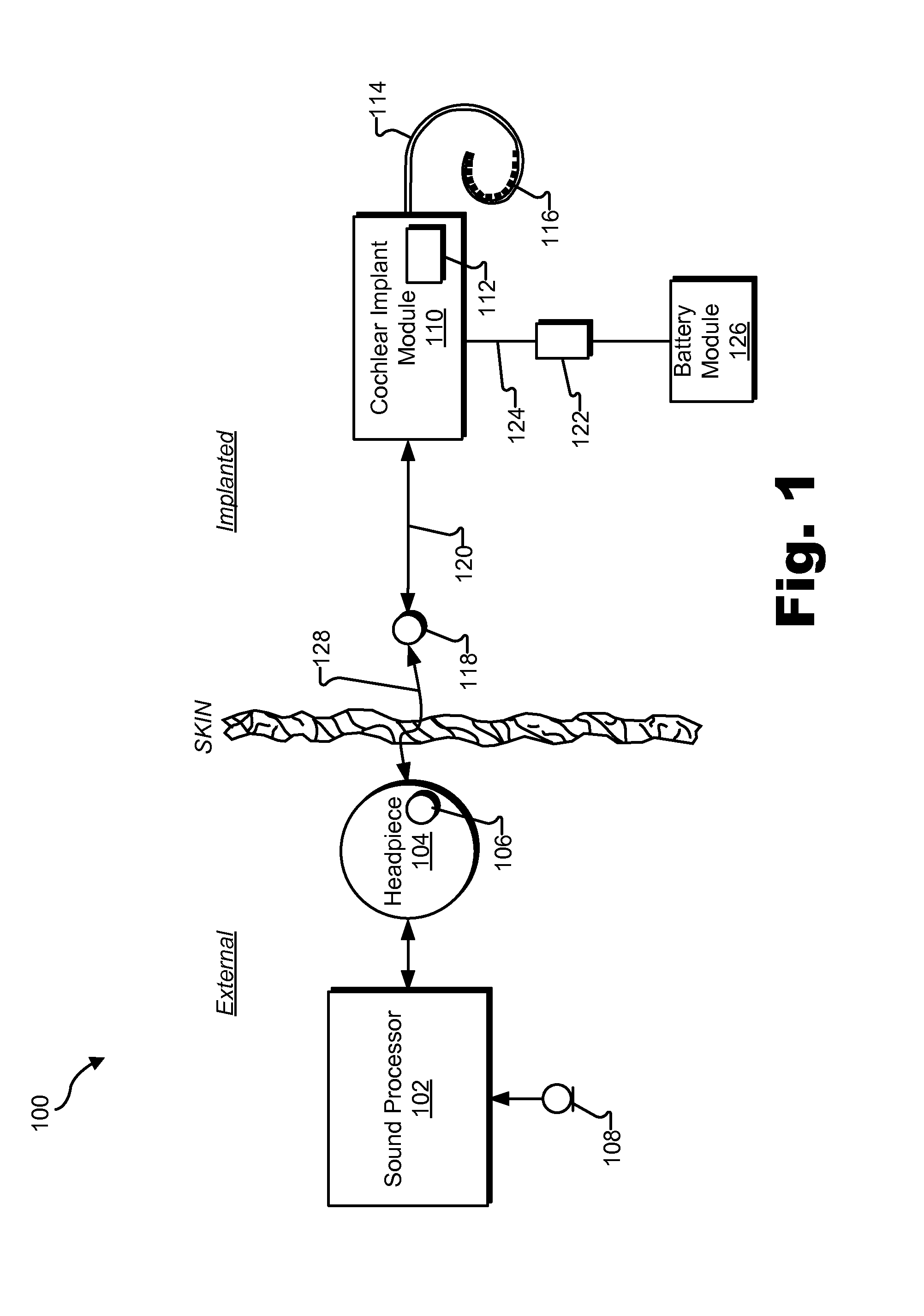 Connectorized cochlear implant systems