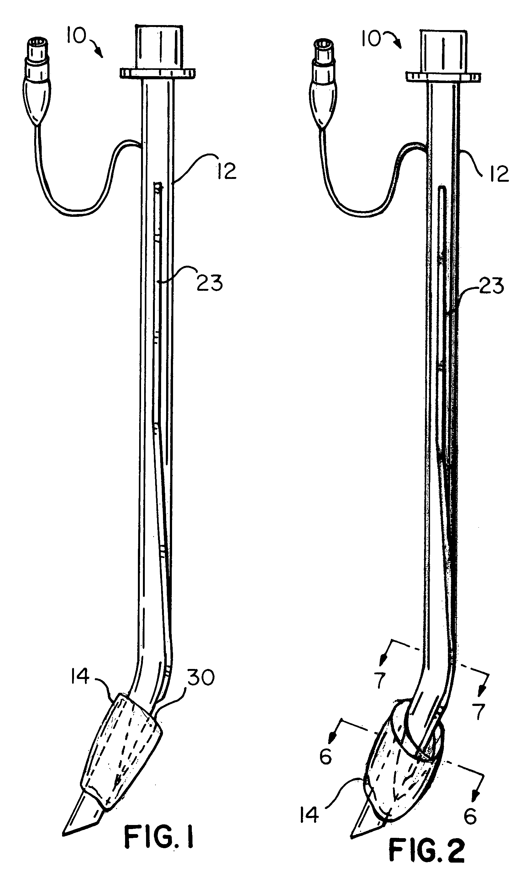Endotrachael tube with suction catheter and system
