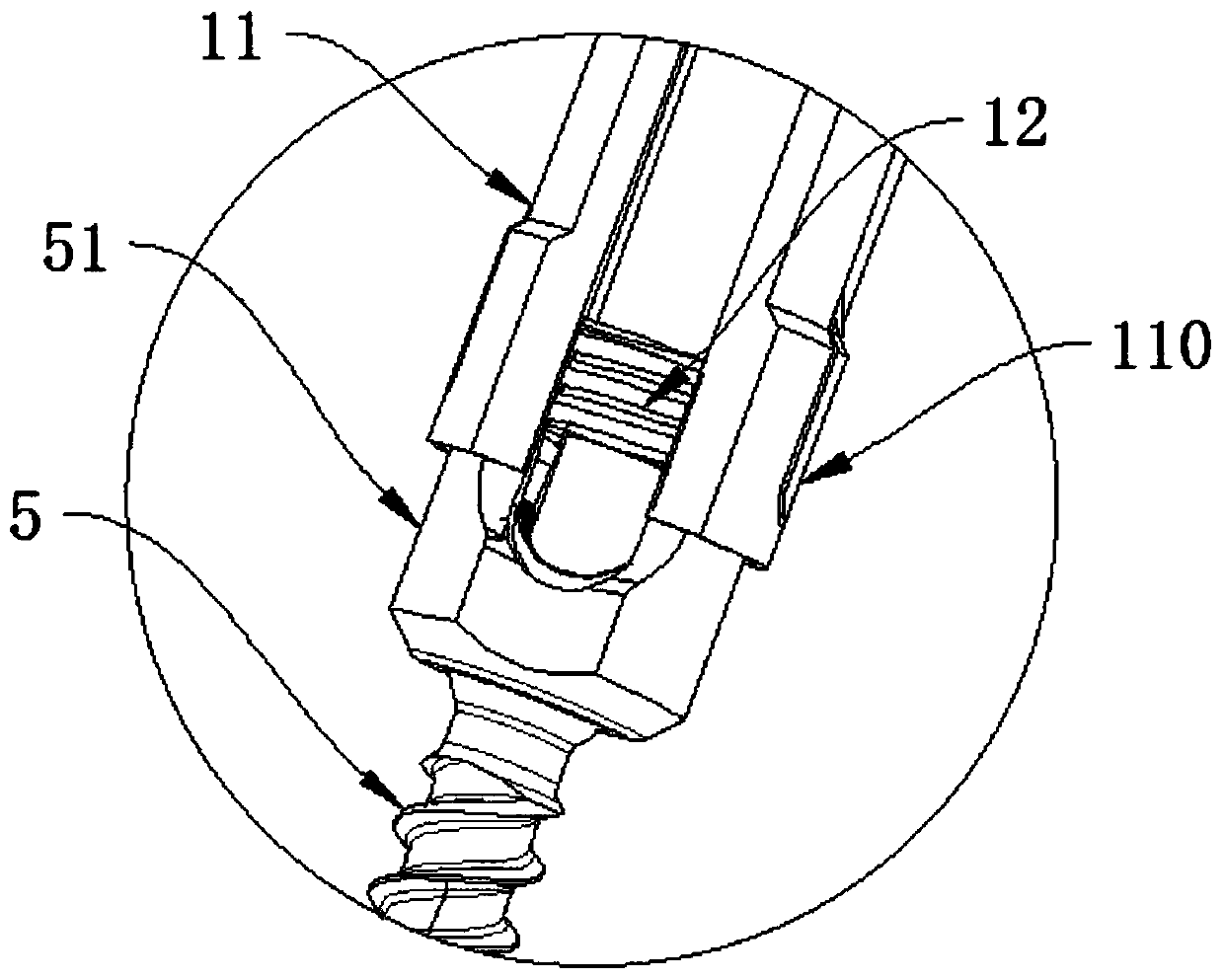 Pediculus arcus vertebrae screw screwing wrench