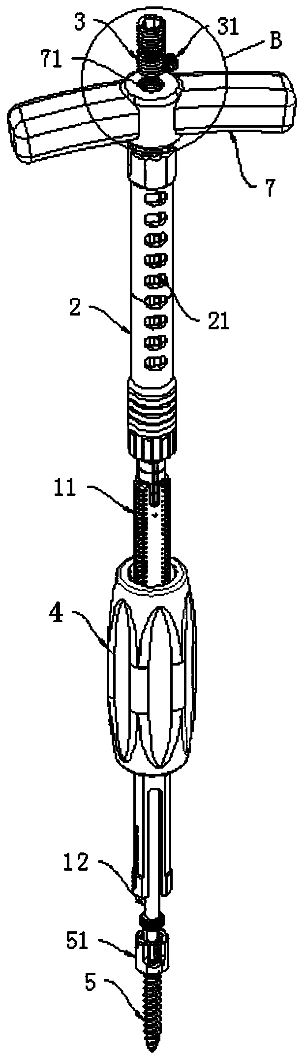 Pediculus arcus vertebrae screw screwing wrench